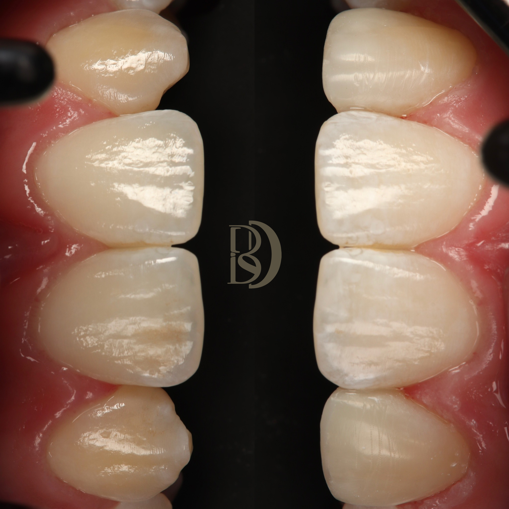 Peg laterals x2 composite.png