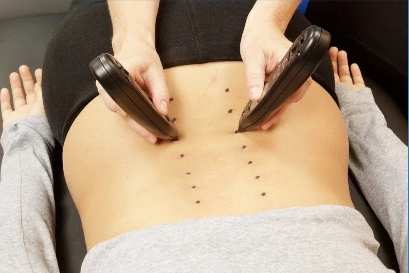 How Scar Neurostim Therapy Can Significantly Help With Pain Management