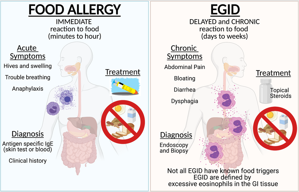 About 1 — Kuang Allergy Research Lab