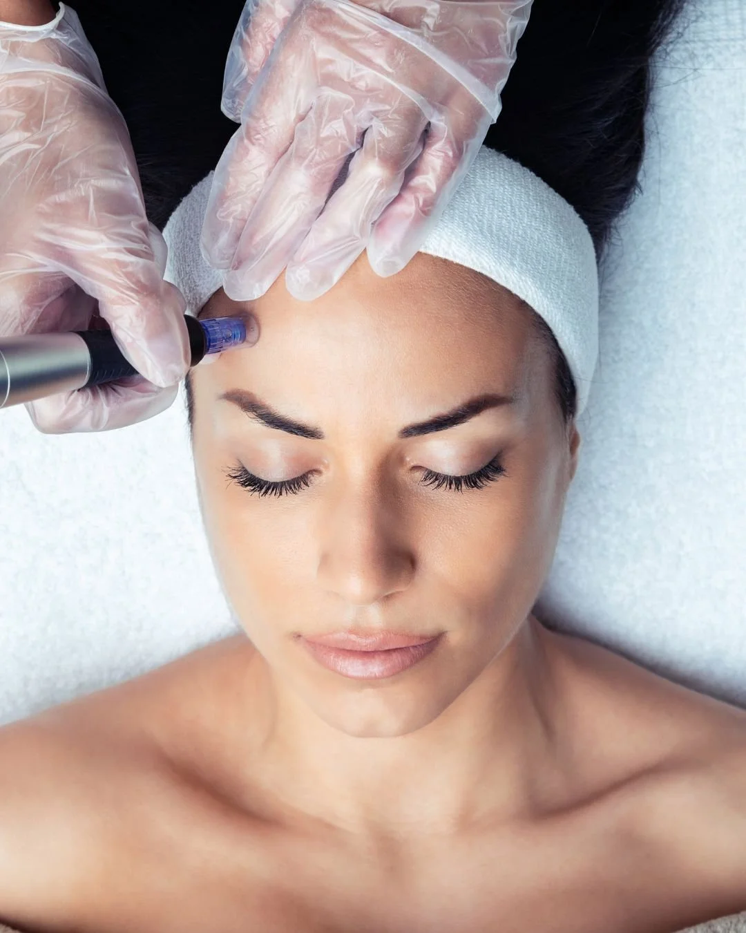 Clinical Cosmetics - Microneedling .jpeg