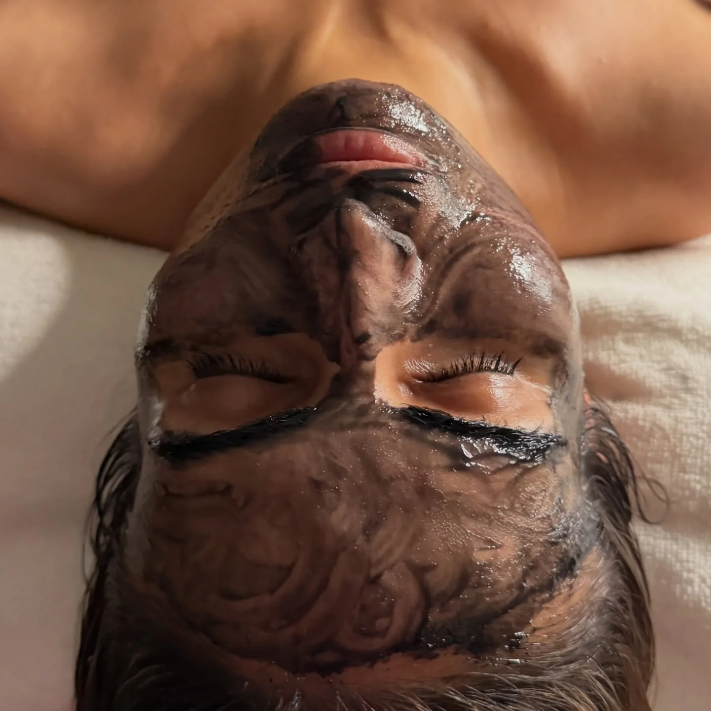 Purifying the skin from within 🖤

#bramptonesthetician #bramptonfacials #bramptonbeauty 
#gtaskincare #gtabeauty #ontarioesthetician #skincareroutine 
#facialtreatment #deepcleanseskin #charcoalmask #detoxfacial #thegoodskinstudio #itsthegoodskinstu