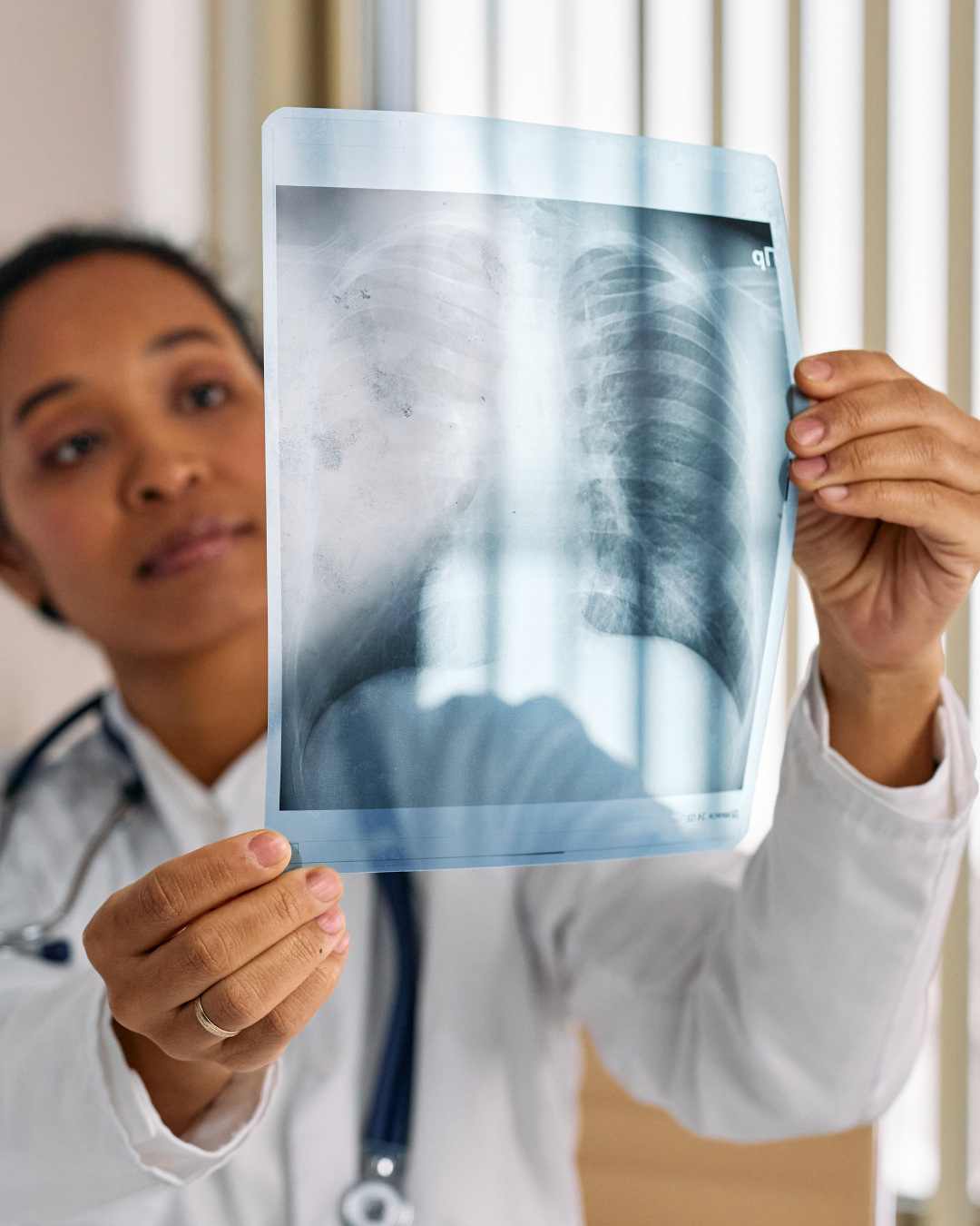 Bone Health 