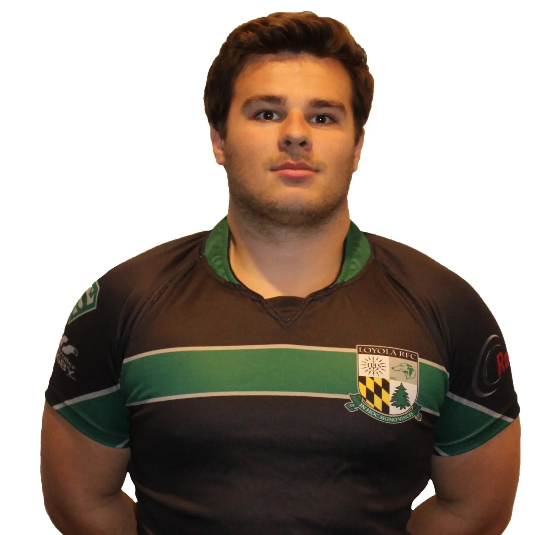 Young man in rugby shirt with bruised eye, crossed arms, neutral expression