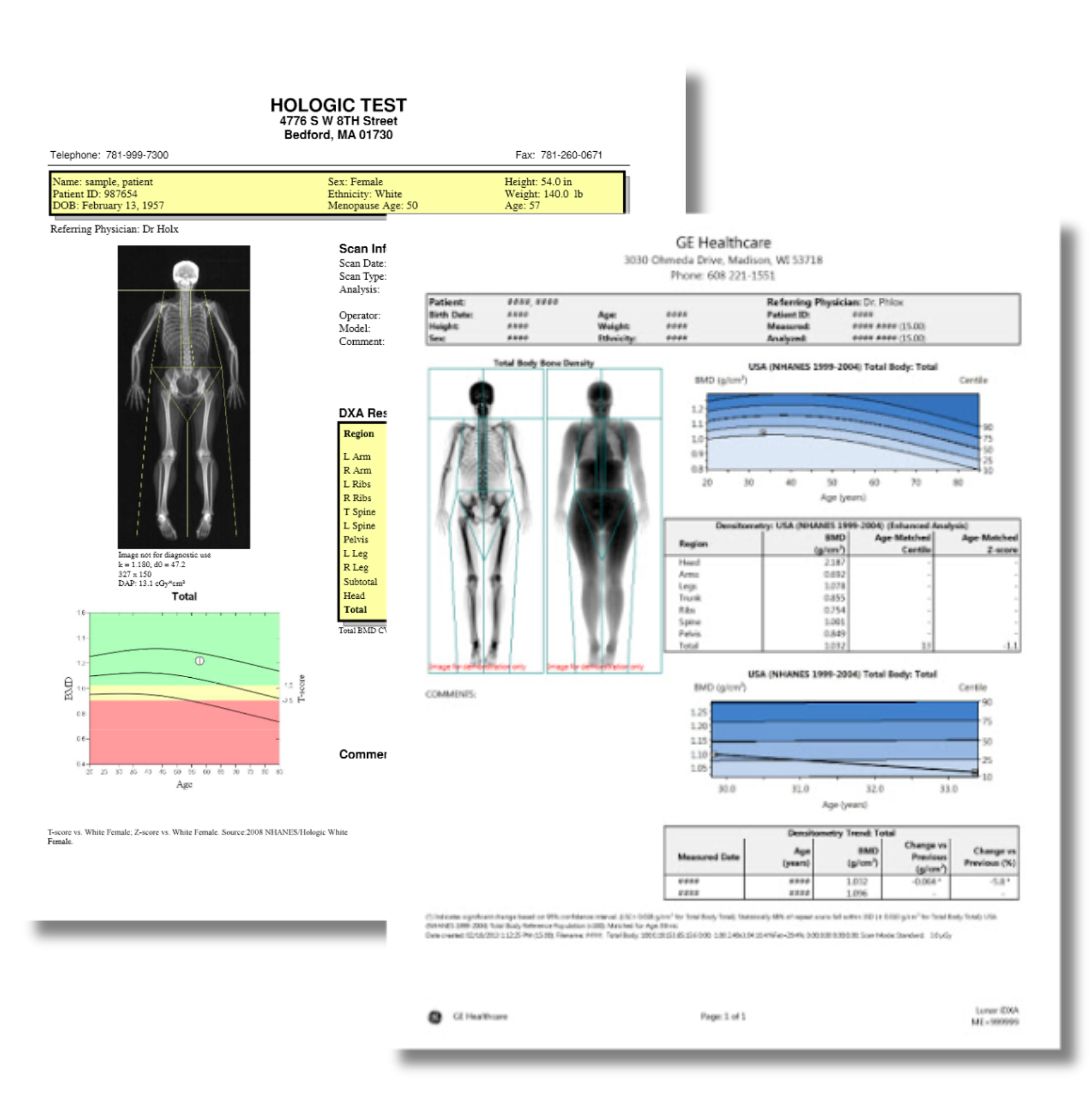 GE and Hologic DEXA