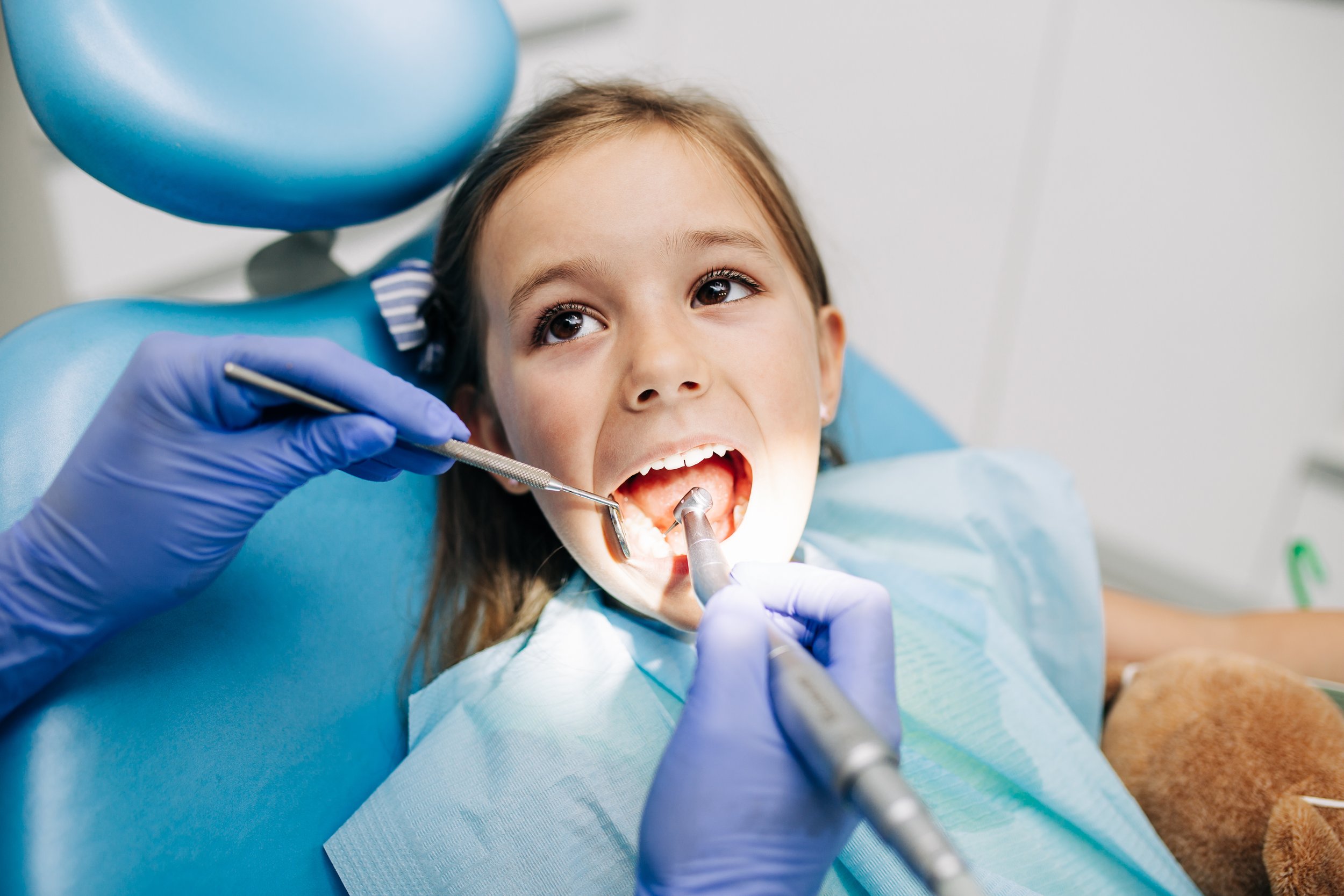 How Dental Sealants Protect Your Child’s Teeth