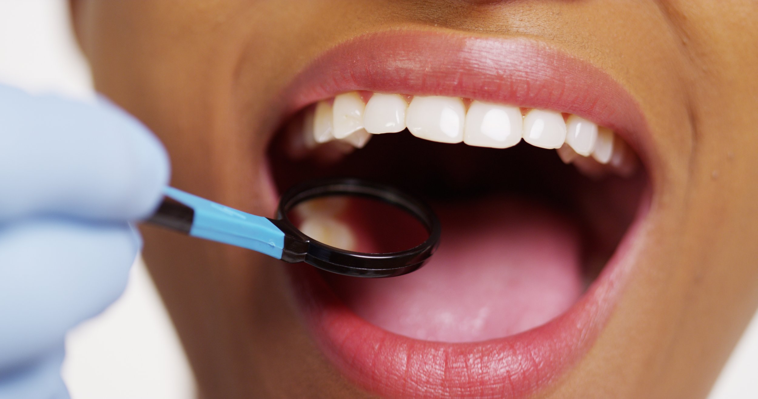 Why Regular Dental Checkups are Crucial for Your Oral Health