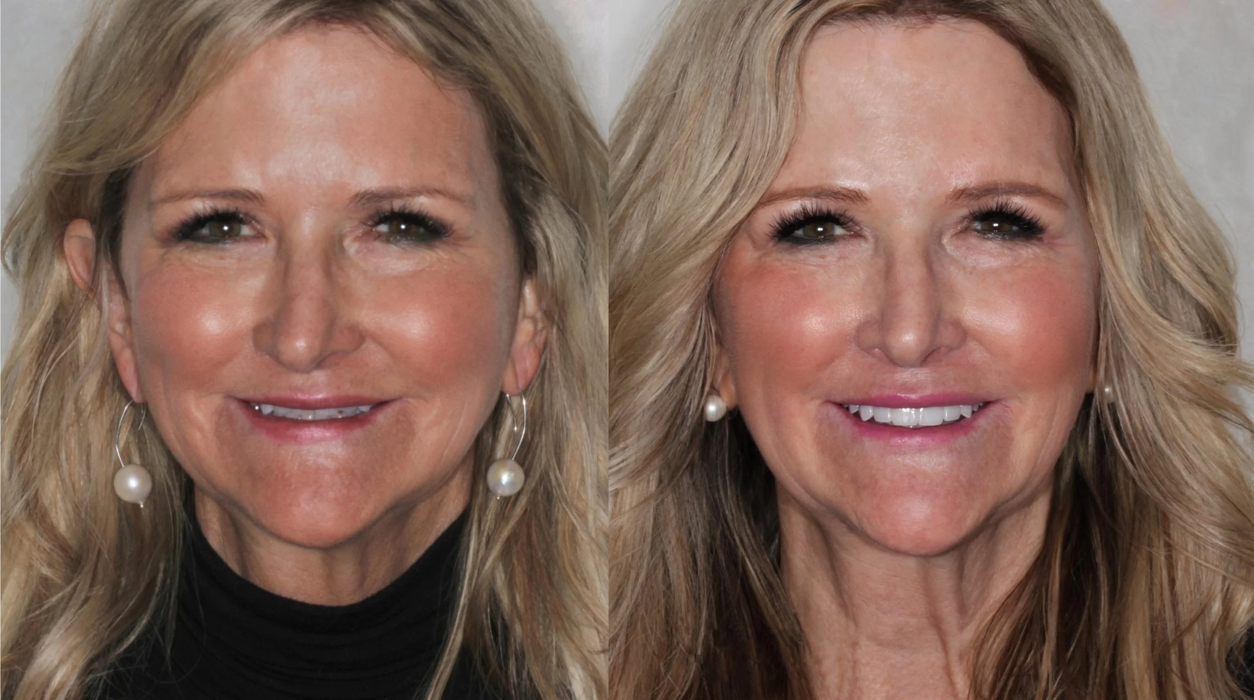 Ageless Smile full face 4.jpg