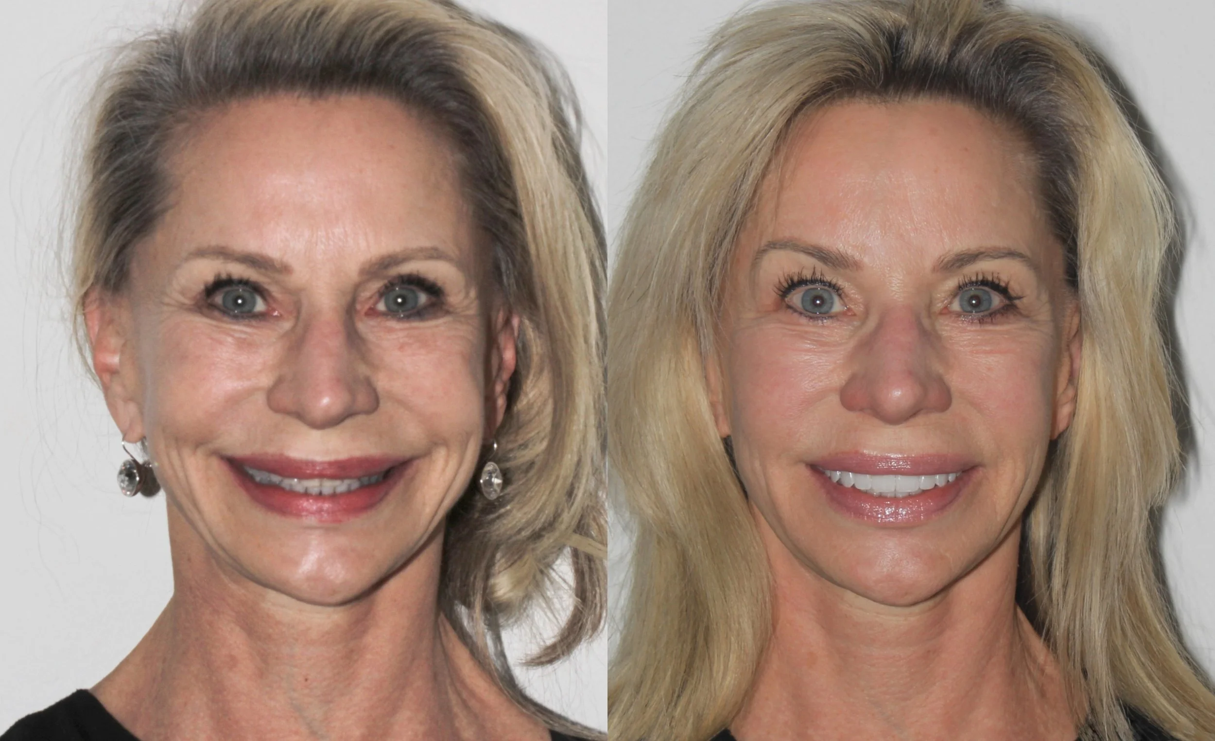 Ageless smile full face 2.jpg