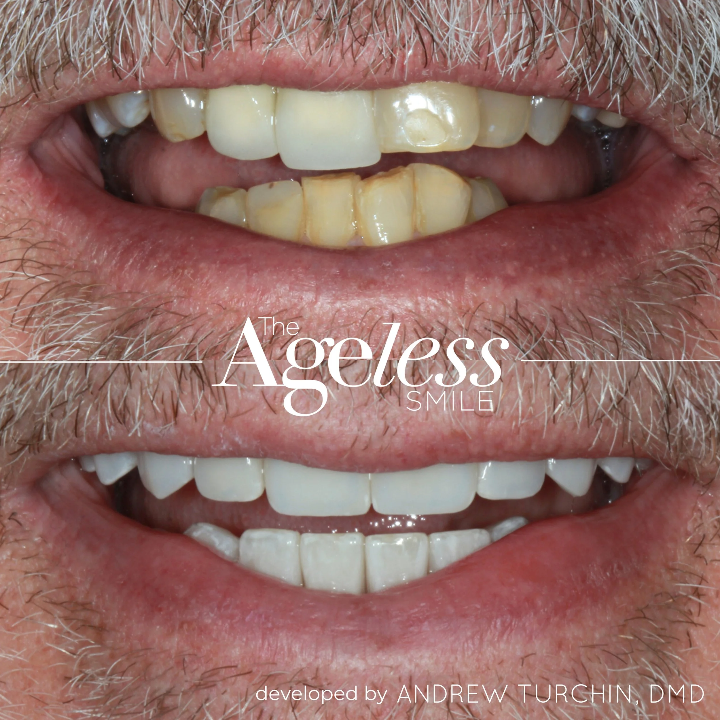 Ageless B&A copy 9.jpg