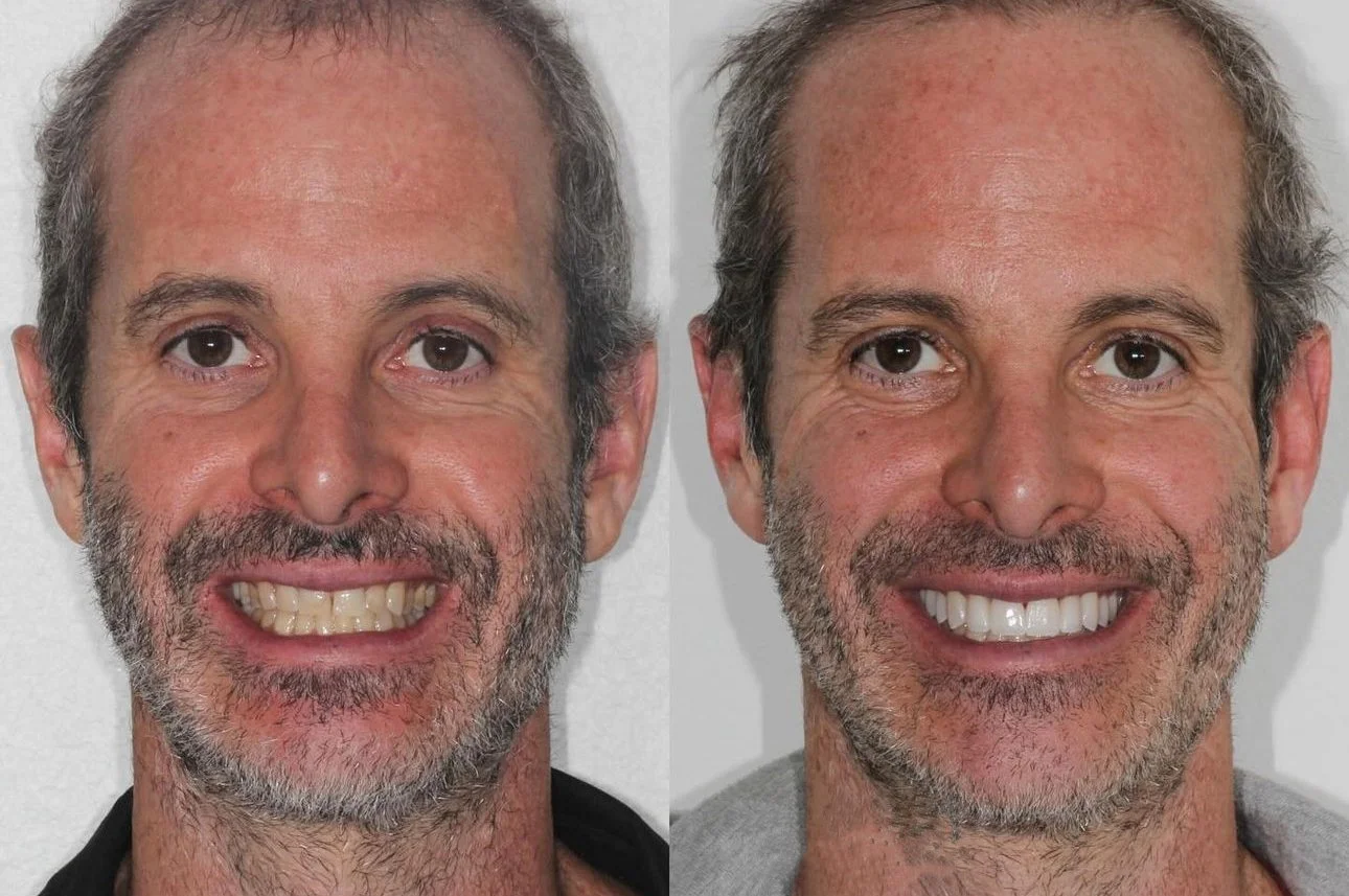 Ageless Smile full face 1.jpg