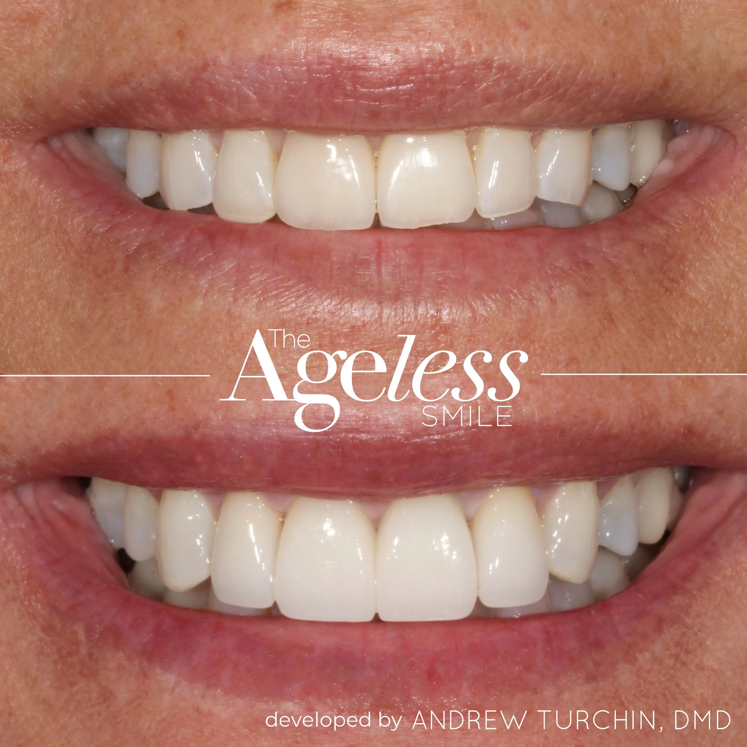 Ageless B&A 24.016.JPG