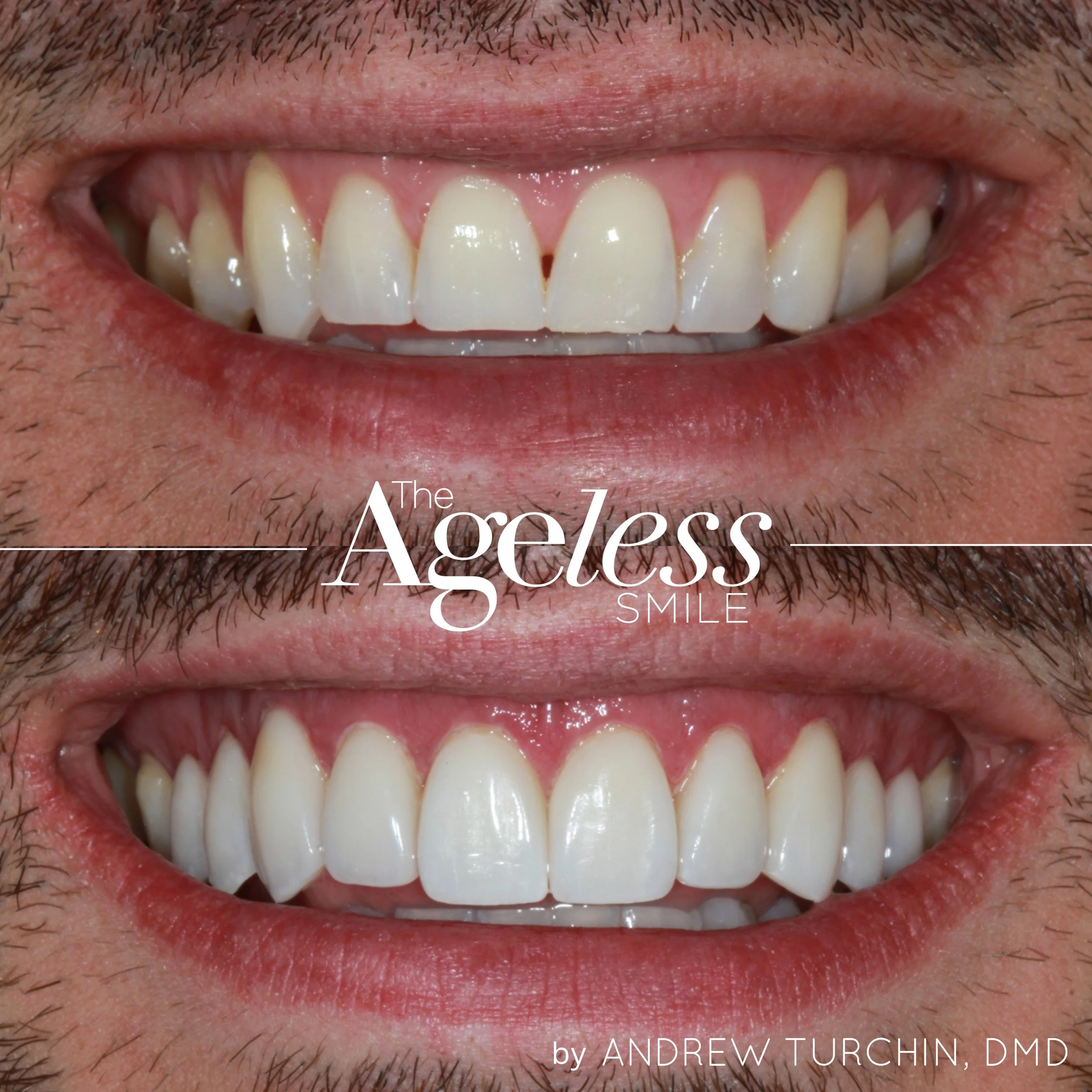 Ageless B&A copy 2.jpg