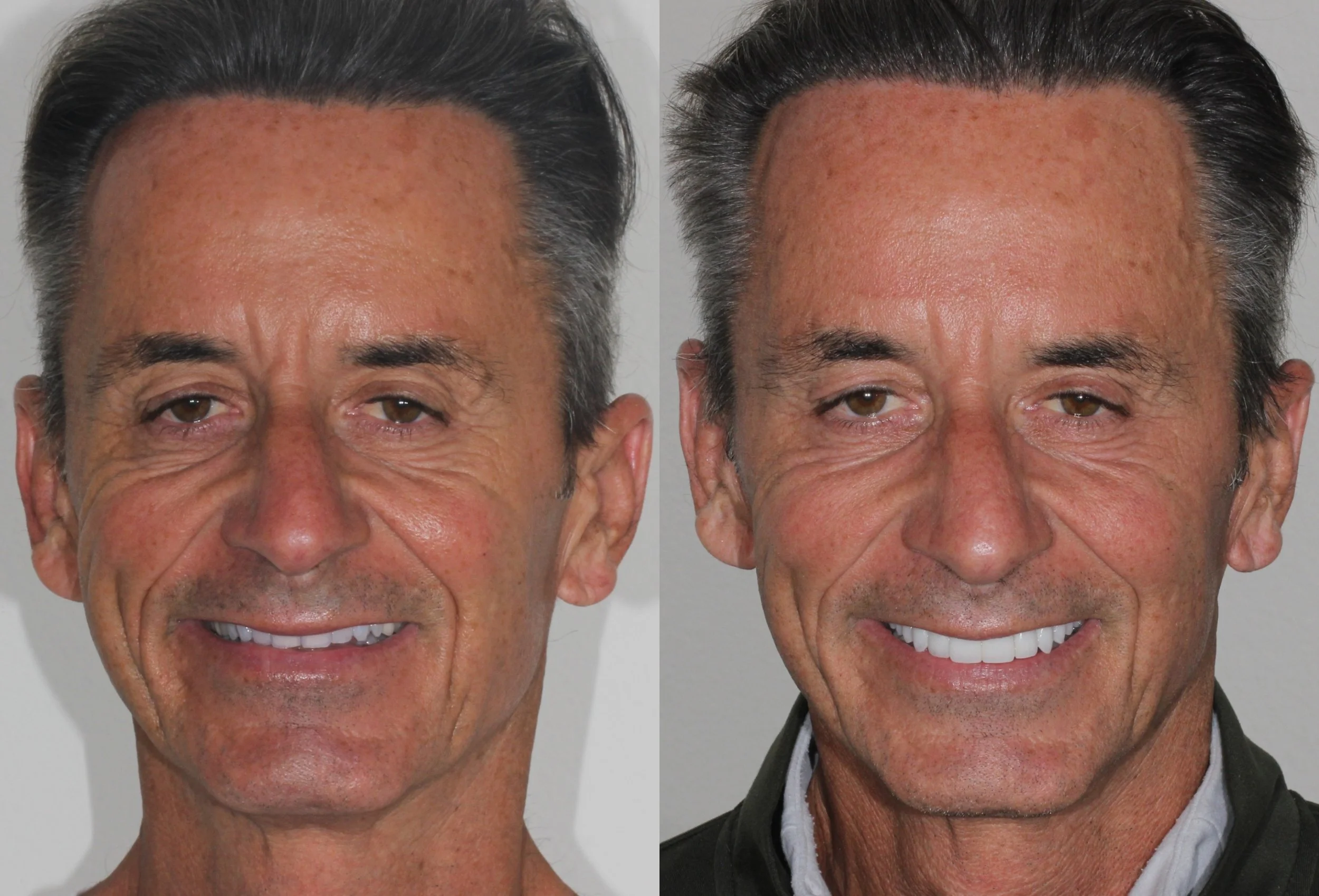 Ageless Smile full face 5.jpg