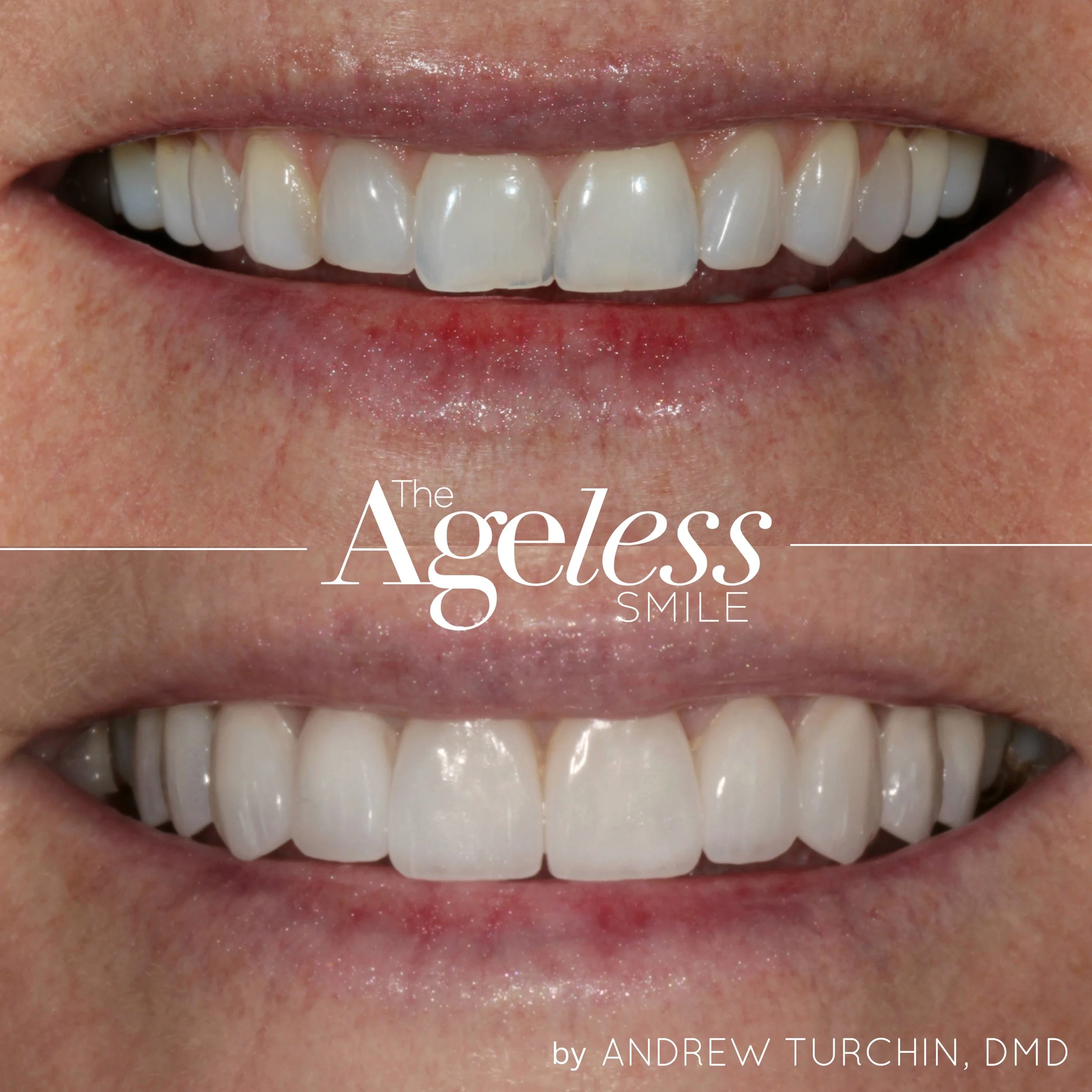 Ageless B&A copy 11.jpg