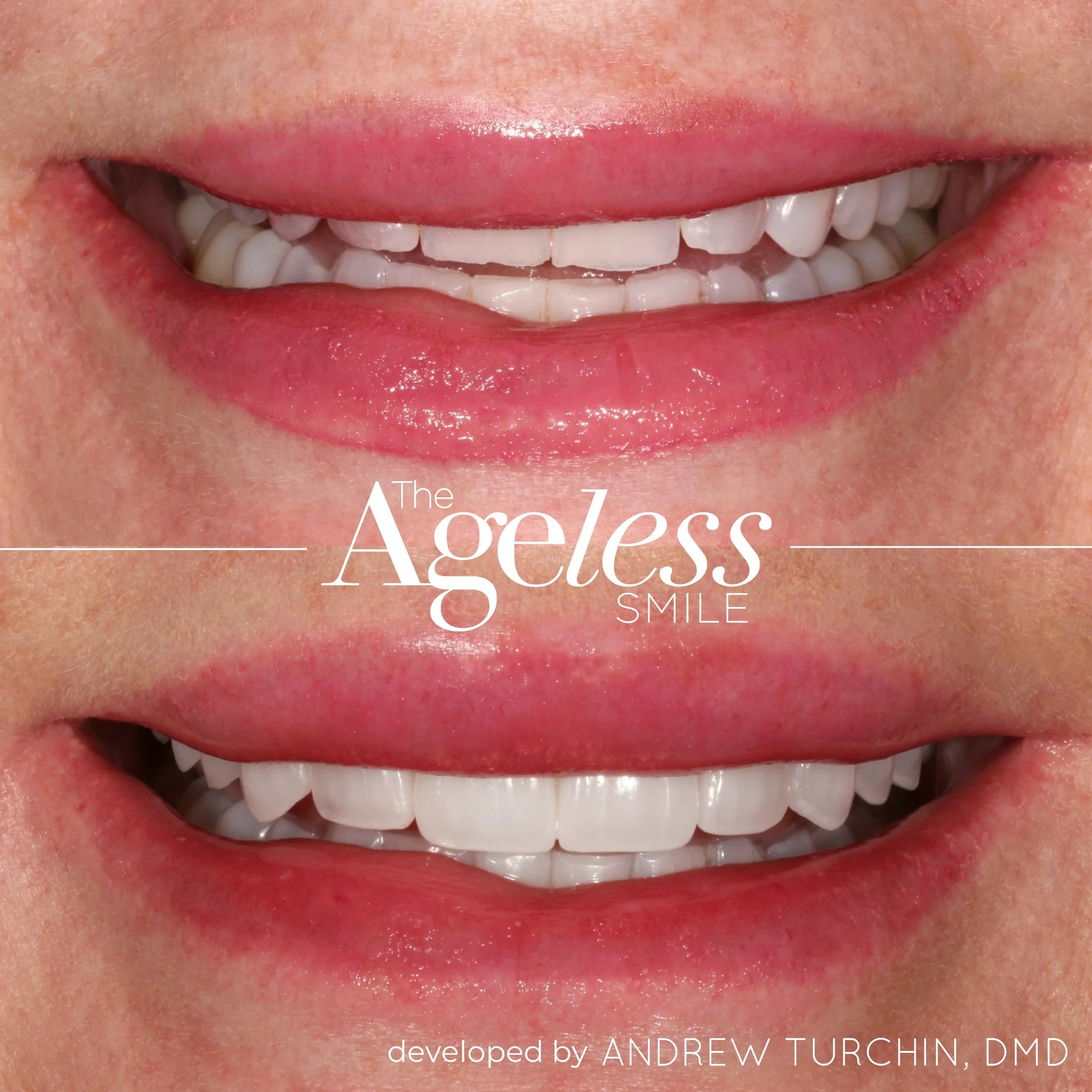 Ageless Smile 24.016.JPG