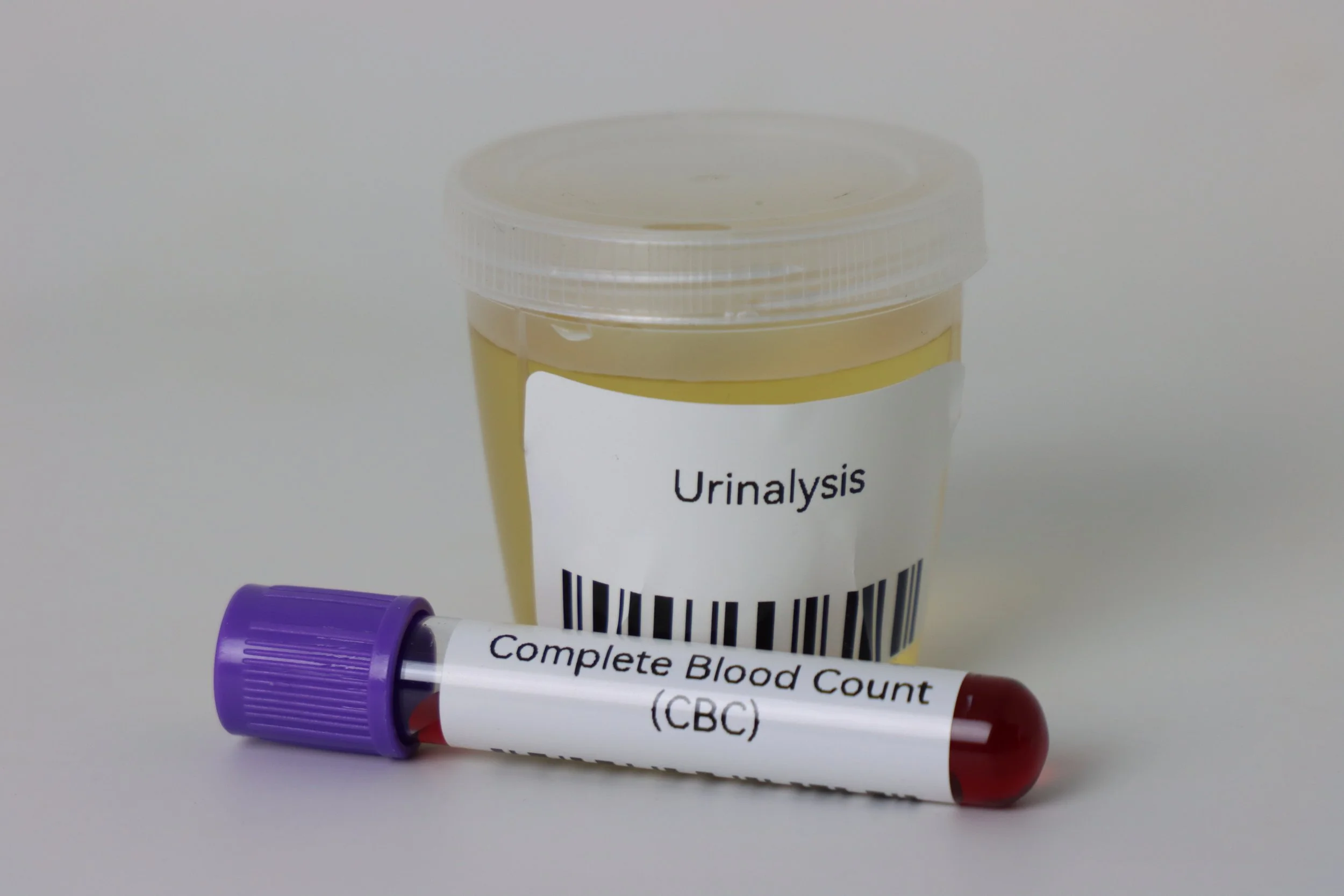 Blood and urine specimen collection materials for accurate diagnostic testing.