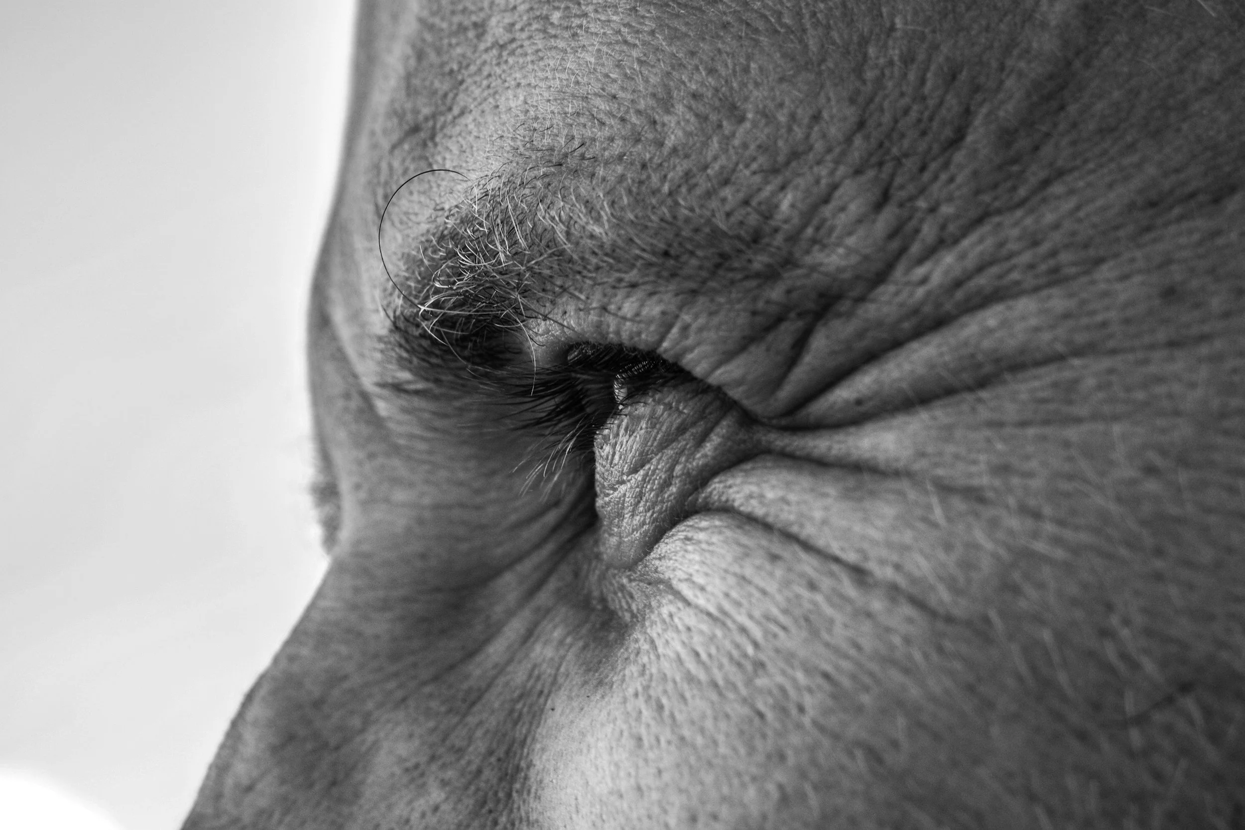 Cataracts: Understanding the Leading Cause of Vision Loss after 40
