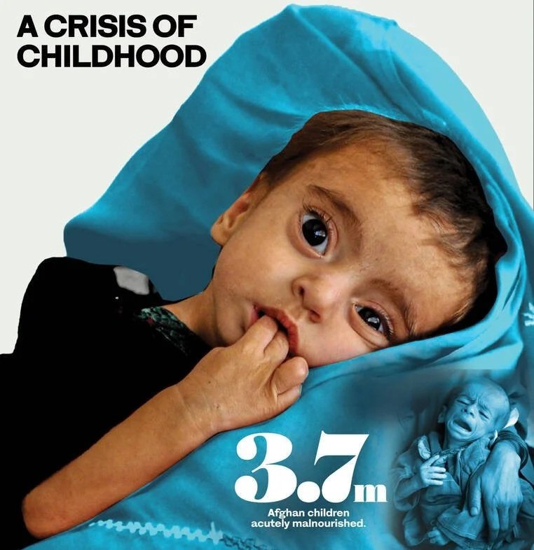 Why one million Afghan children face life-threatening malnutrition