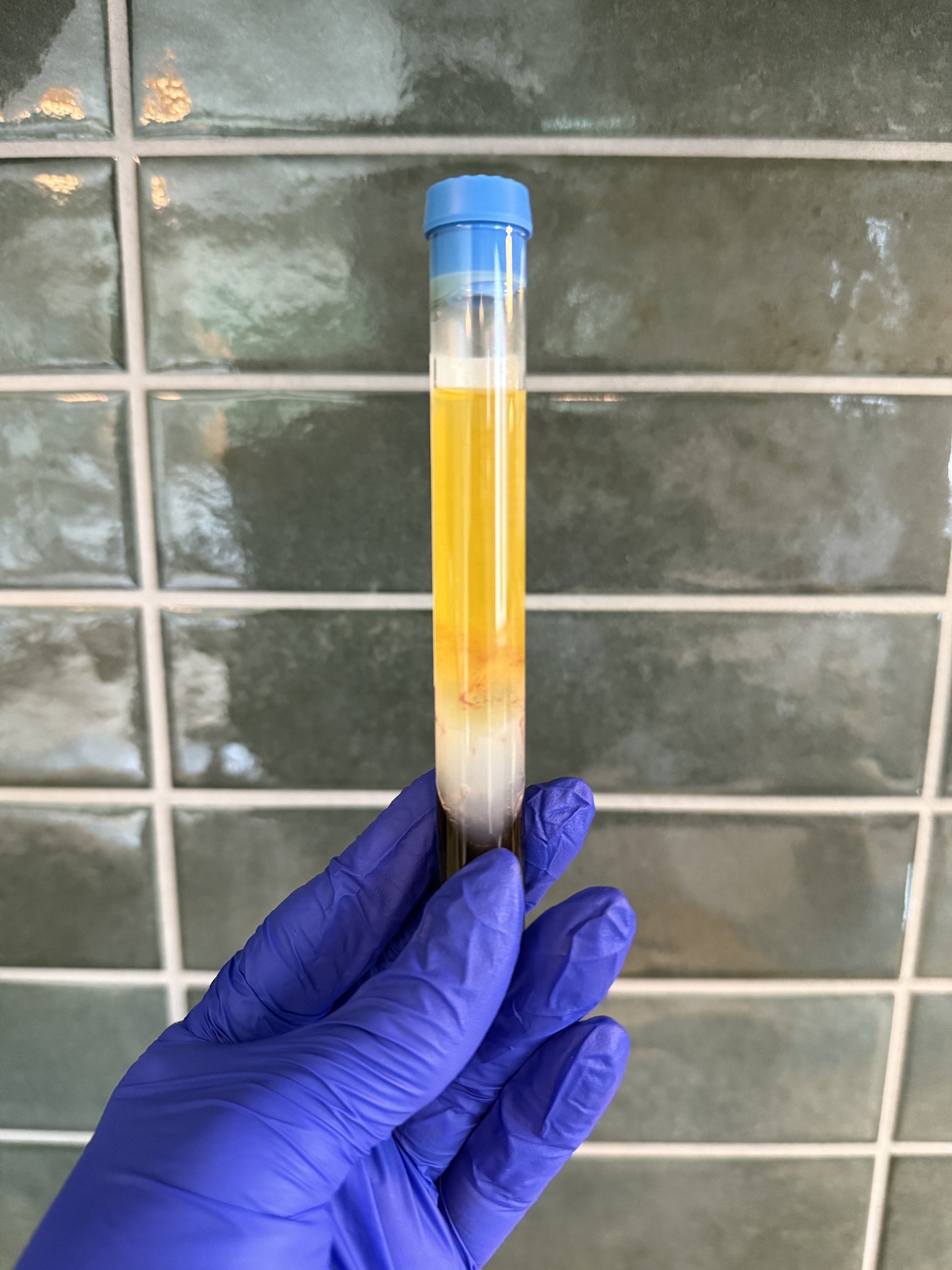 PRP or Microneedling: Two Ways to Get Glowy Skin (and How to Choose)