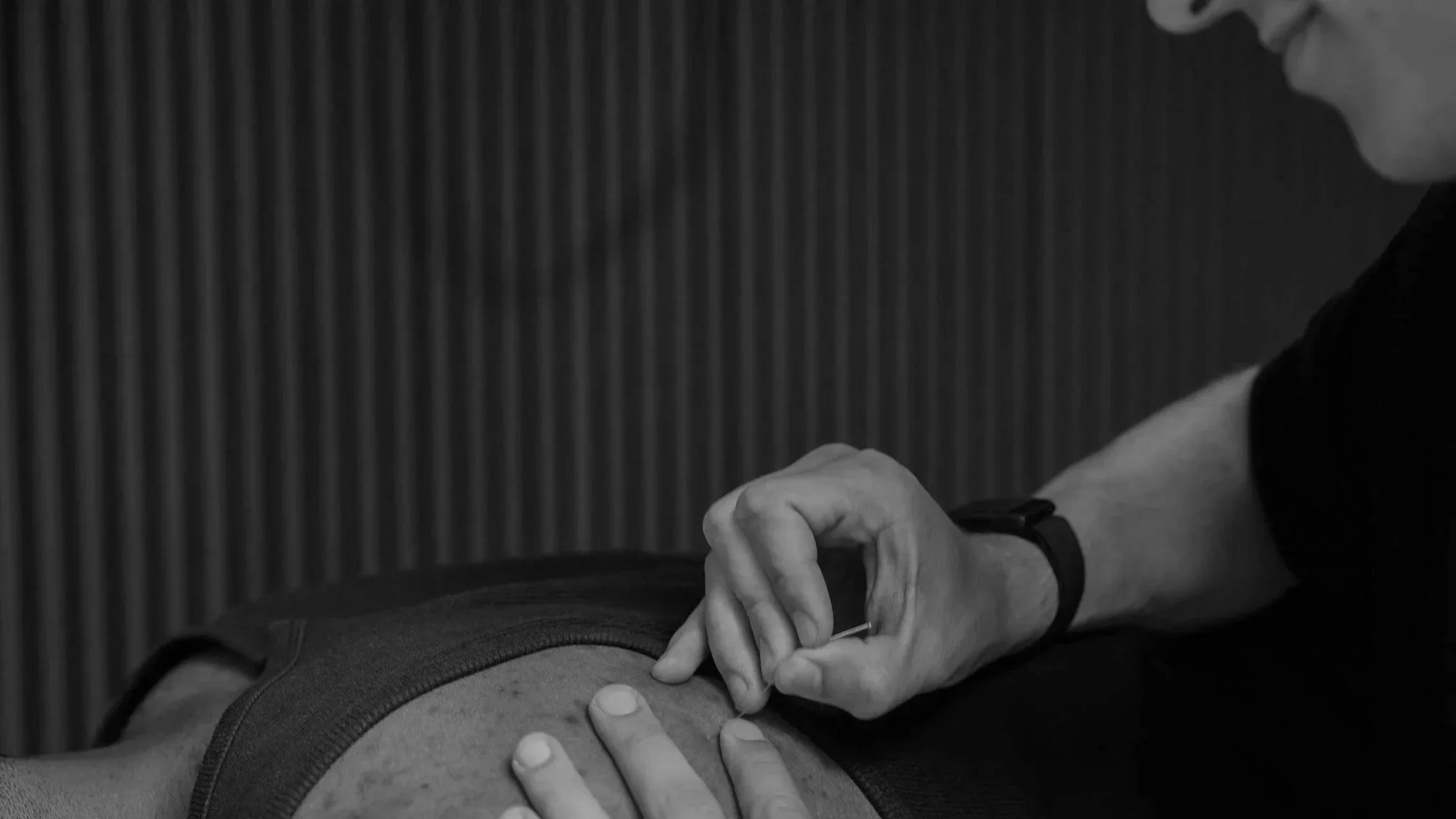 Dry needling, weefsel herstel, fascia, spierknopen loswerken
