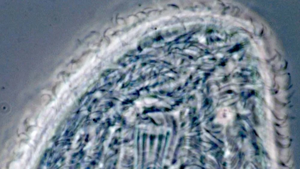 Chilodonella (ciliates) - Ponds Guide