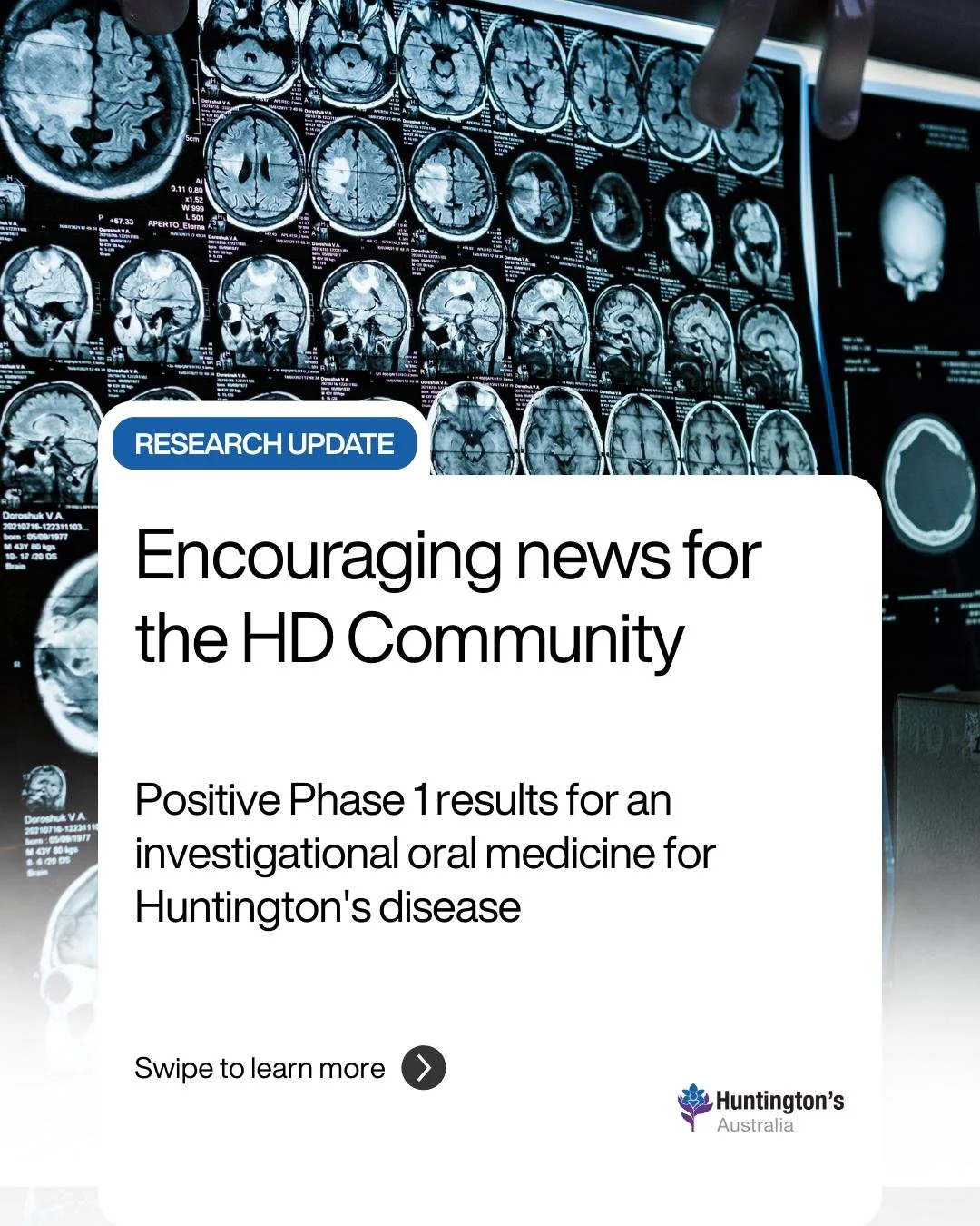 Encouraging news to start 2026 💙

@skyhawk.tx has shared positive early results for SKY-0515, an investigational once-daily pill being studied for Huntington's disease.

The Phase 1 trial showed:
✨ The drug was safe and well tolerated
✨ 62% reductio