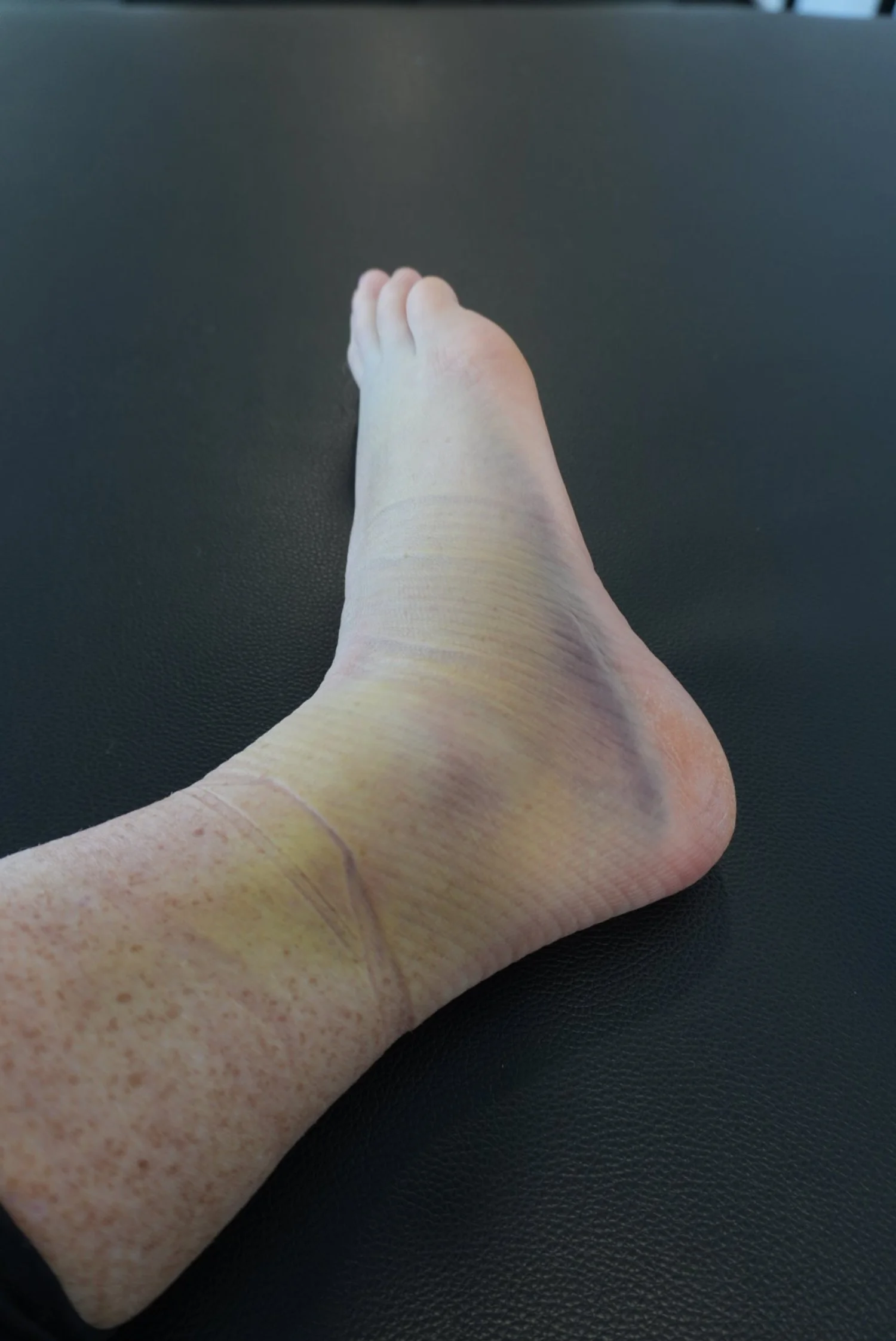 ankle rehab.JPG