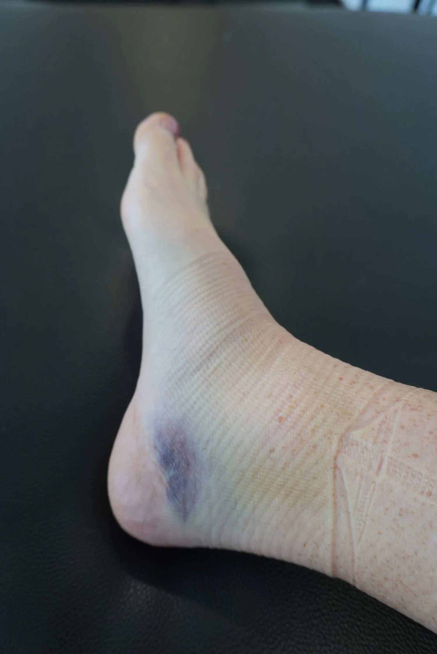 ankle physio.JPG