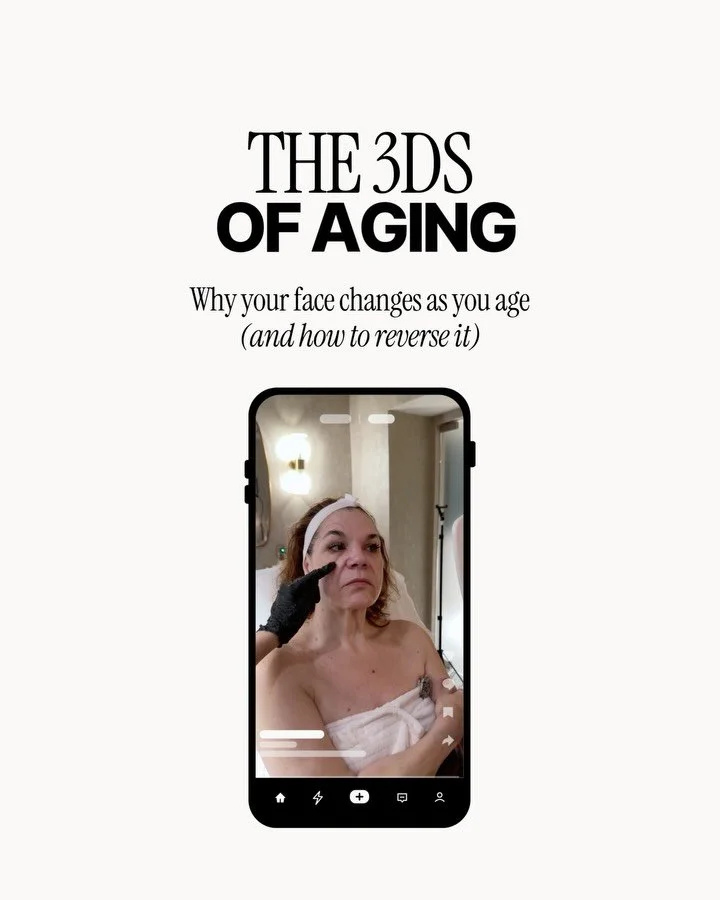 The way your face ages isn’t random, it follows three key patterns we call the 3Ds of Aging🧏🏻‍♀️
Most treatments only touch the surface... but aging runs deeper. That’s why with the AgeSculpt™ we go layer by layer to lift, sc