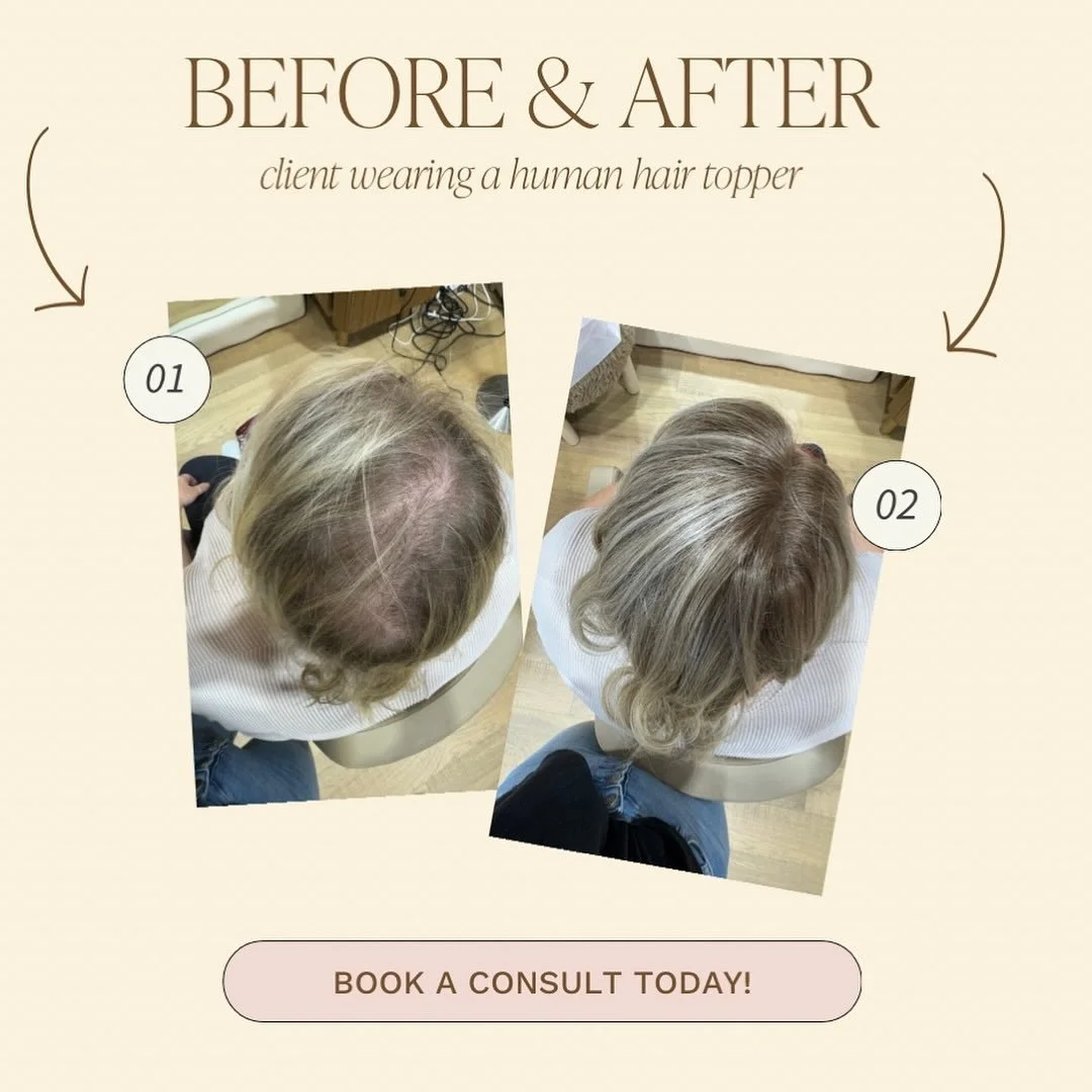 &bull; Before &amp; After &bull; A little extra coverage can make a world of difference! Our toppers add instant volume, fullness, and confidence&mdash;beautifully blending for a natural look. 💕 

#ConfidenceInEveryStrand