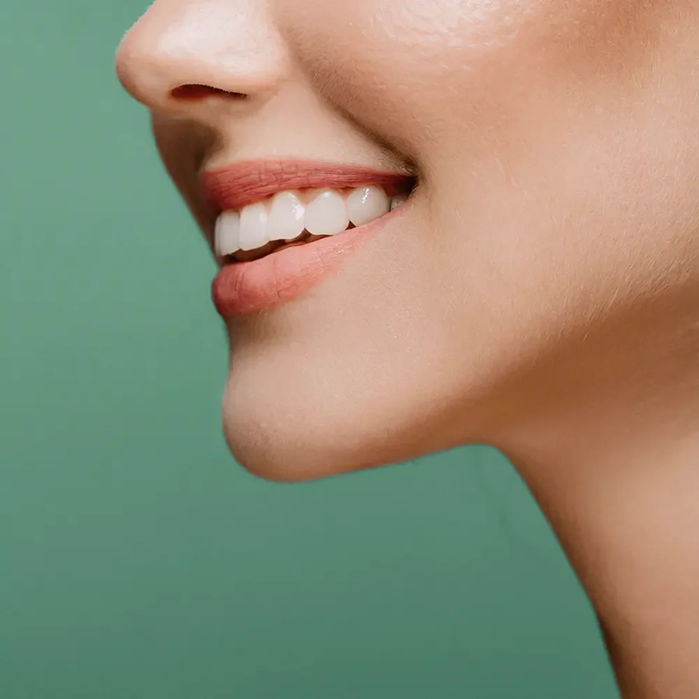 mujer sonrisa blanqueamiento dental