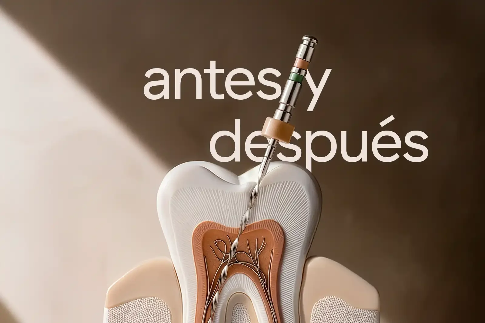 Antes y después de un tratamiento de conducto: caso clínico