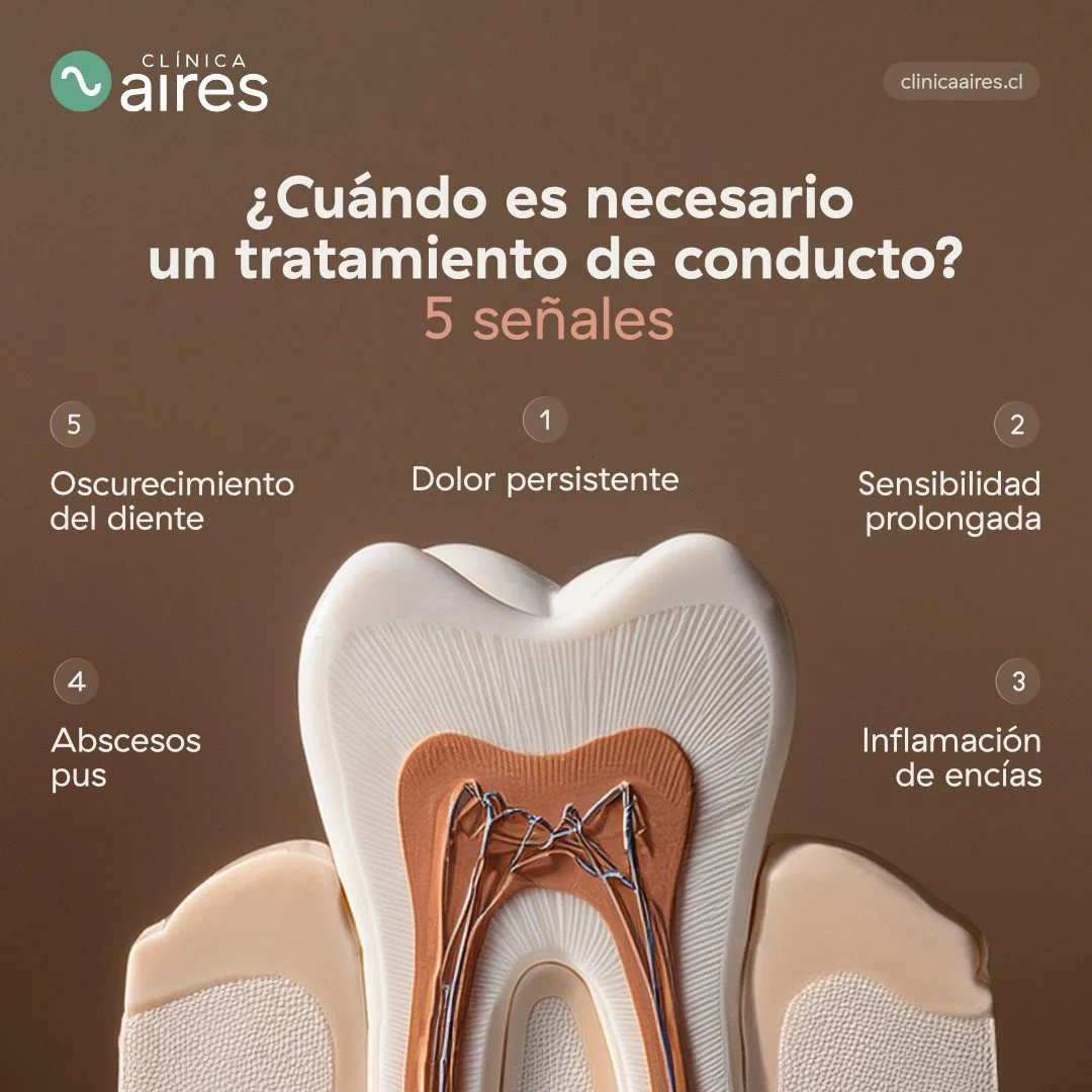 ¿Cuándo es necesario un tratamiento de conducto?