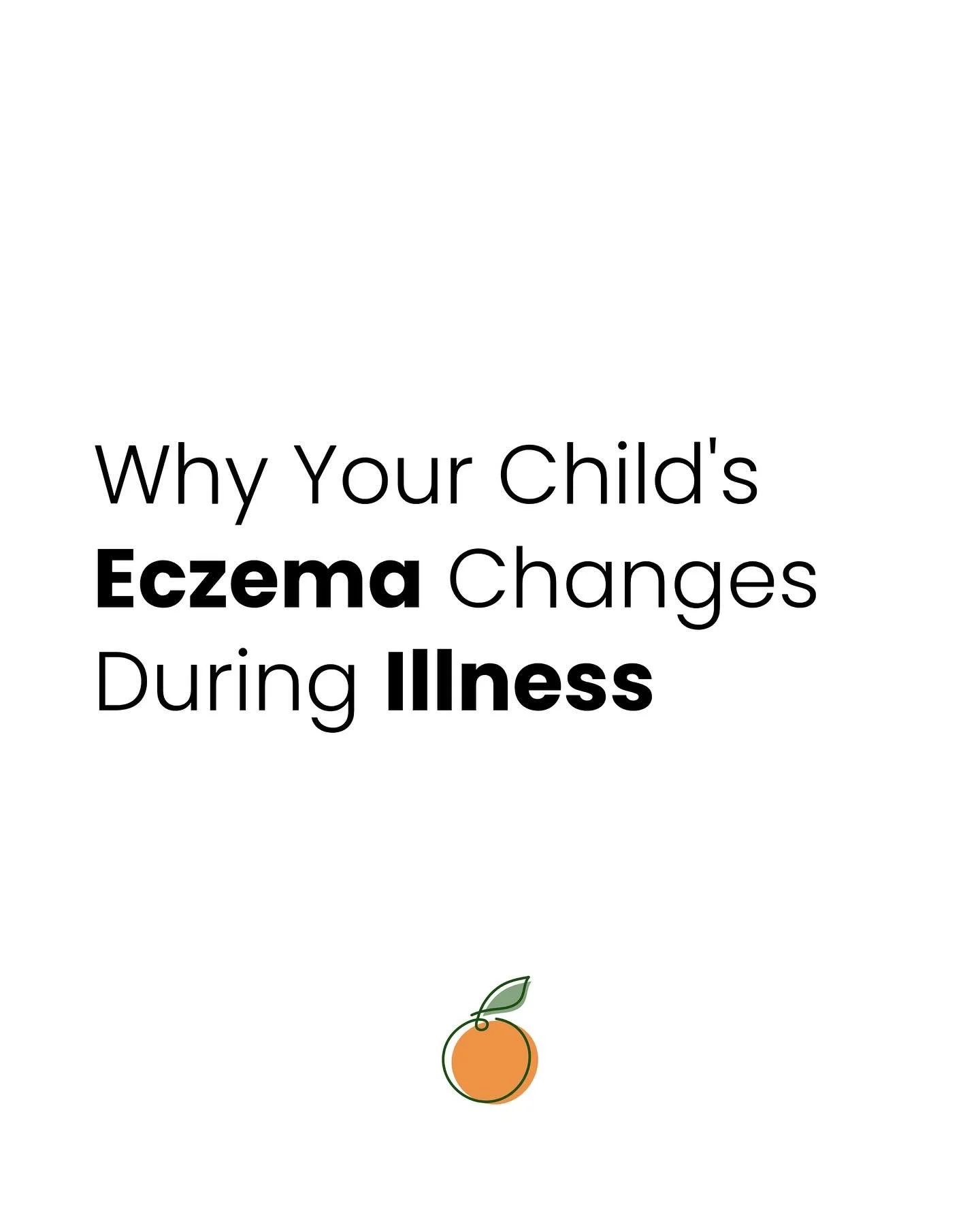 Almost all of my clients are sick right now. There are so many random bugs going around! In kids with eczema, there can often be a change in skin that happens when the immune system gets another stressor. 

DM &ldquo;MICROBIOME&rdquo; to optimize you
