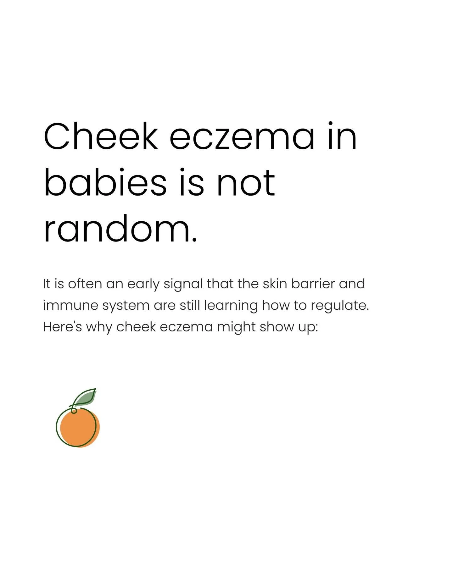 So many of the babies I work with have cheek eczema! Just this week I&rsquo;ve met with 4 so far. Here&rsquo;s why cheek eczema can take some extra time to heal!