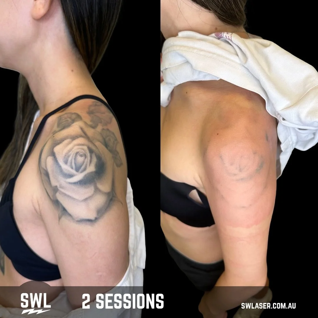Same client, different spots, different styles.

A perfect reminder that not all tattoos fade at the same rate, even after the same number of sessions!