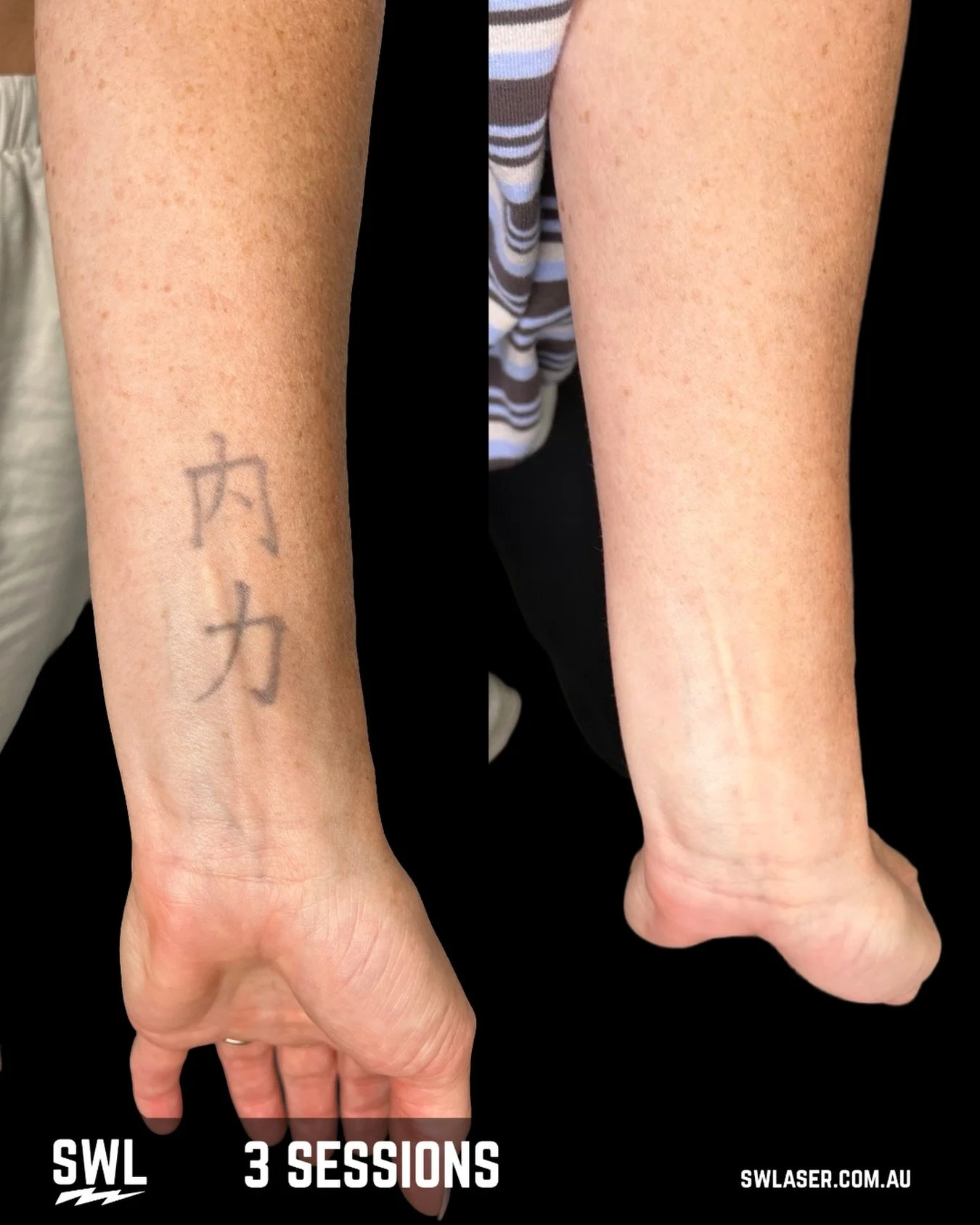 Invest in yourself and reap the rewards! 

We will be closed from December 22nd to January 1st. Reopening January 2nd! Book in today to get a session in before things get silly! 

📍 Fremantle &amp; West Leederville
📱 0499 527 374
📧 info@swlaser.co