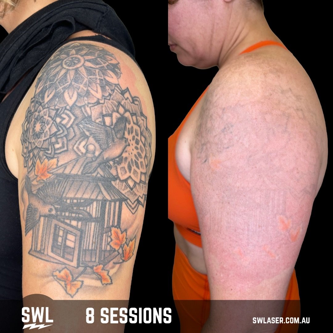 The sooner you start, the sooner it&rsquo;s gone and I promise you won&rsquo;t regret your decision! 

We are in full swing at both our Fremantle &amp; West Leederville location! 

Book in Today!