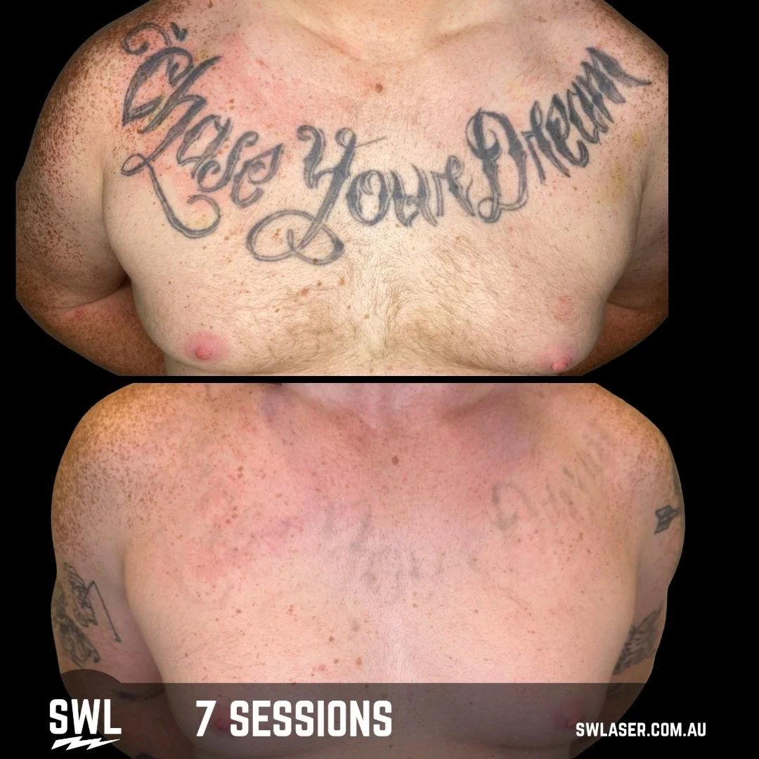 Chase your dreams and start your laser journey  today! 
We are ready to make your dreams come true! 

Video is from Session #4

📍 Fremantle &amp; West Leederville
📱 0499 527 374
📧 info@swlaser.com.au 
GET YOUR FREE QUOTE TODAY!