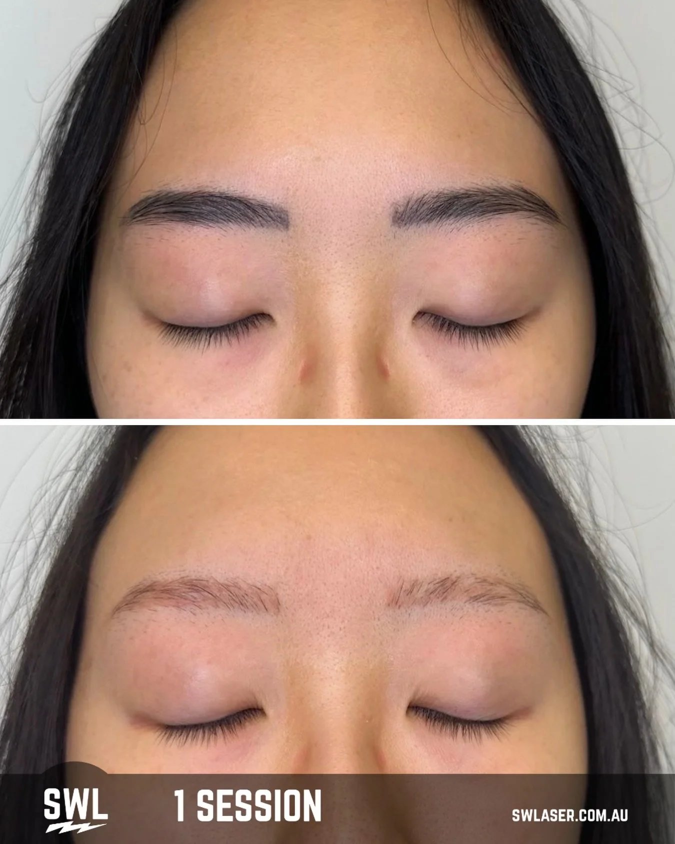 Yup! We can help remove your cosmetic eyebrows! 

Message for a free quote or a free in person consultations!