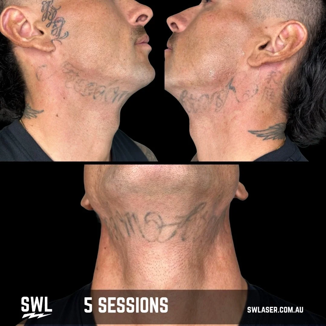 Swipe to see the BEFORE! 

Real Clients
Real Results

Let the Results Do The Talking!