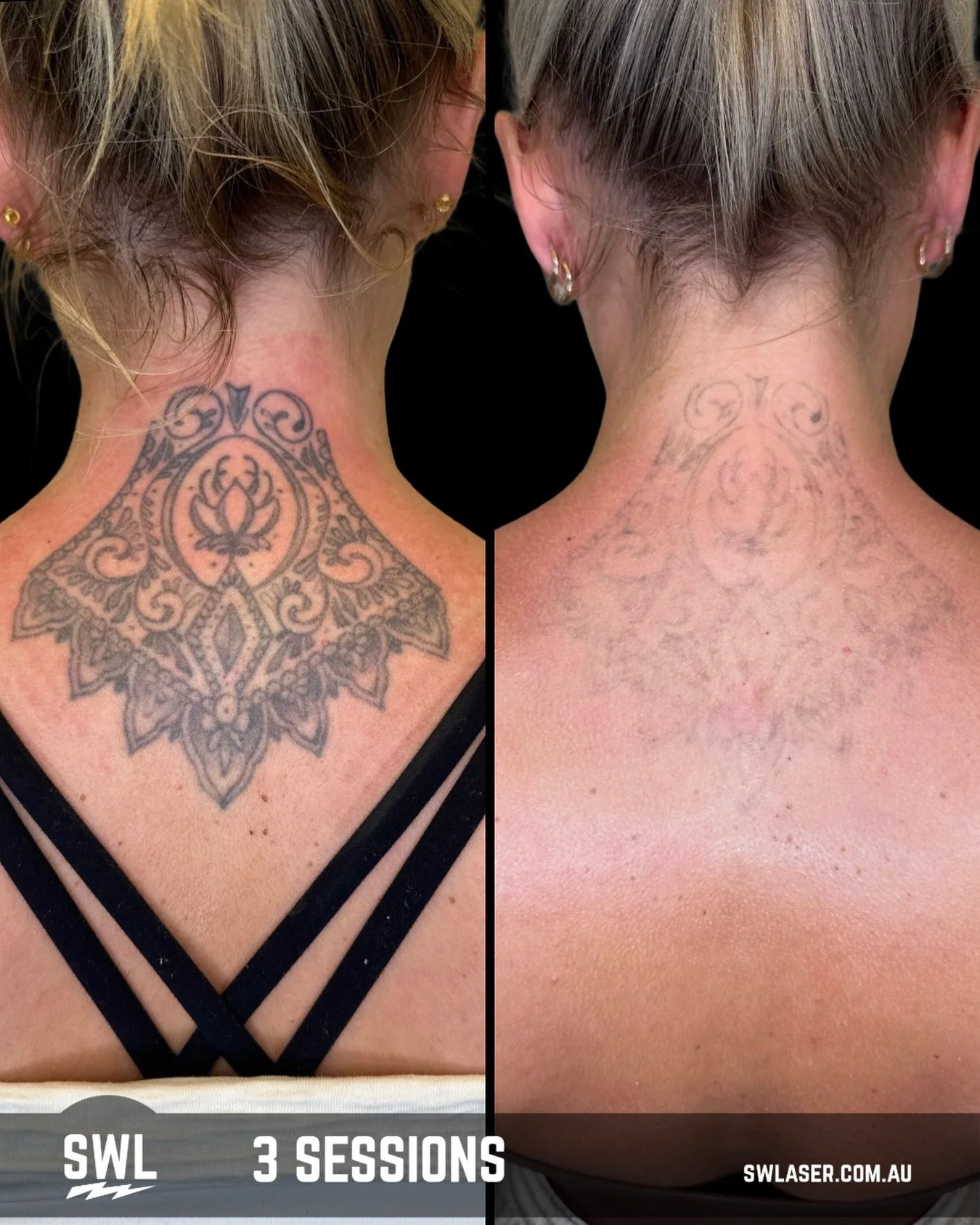 Sometimes a little can go a long way!! 

📍 Fremantle &amp; West Leederville
📱 0499 527 374
📧 info@swlaser.com.au 
GET YOUR FREE QUOTE TODAY!