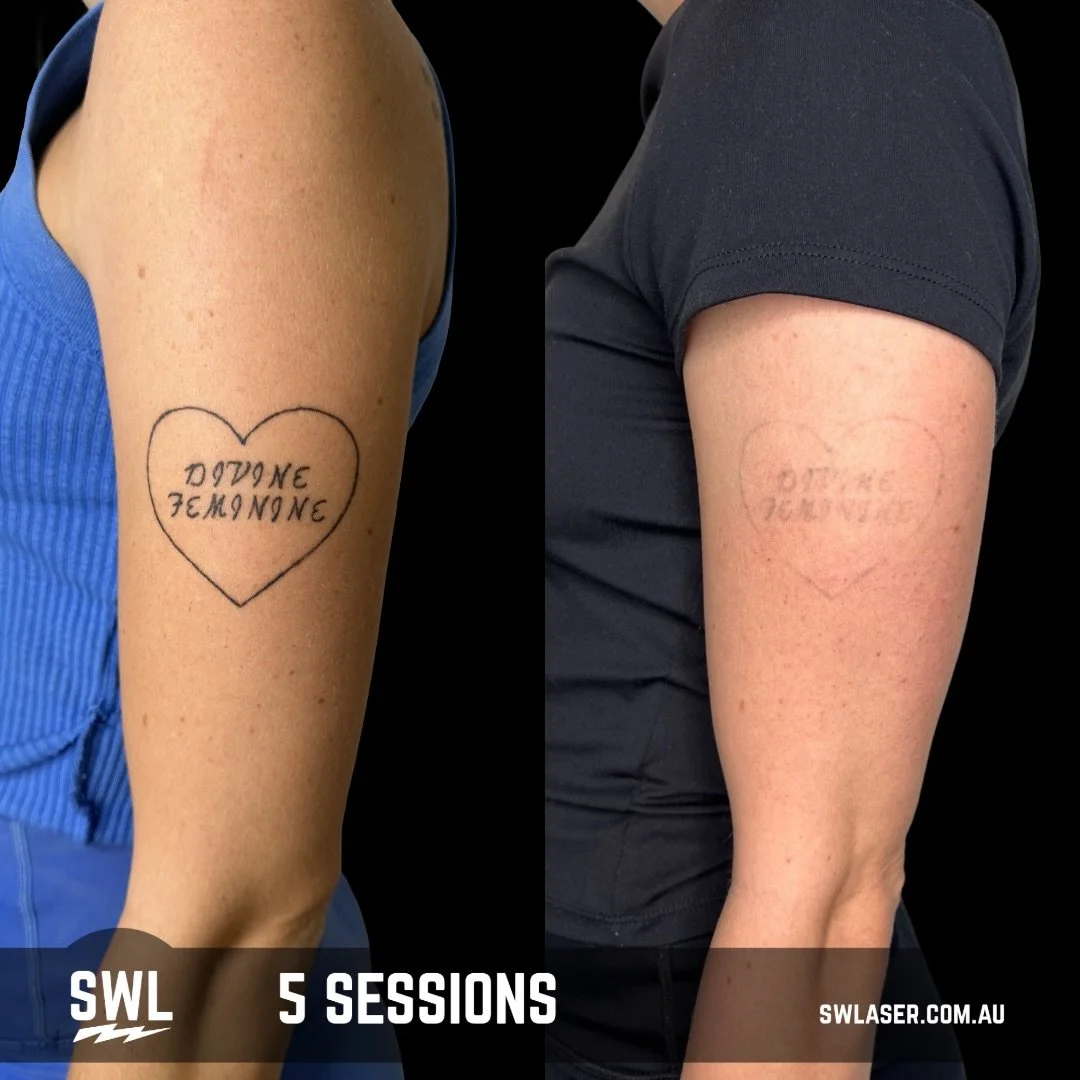 Time flies, so don&rsquo;t forget to invest in yourself and the things that make you feel good.

Laser is a journey. Each session is a step forward towards a fresh start, a new version of you, or simply feeling more confident in your own skin.