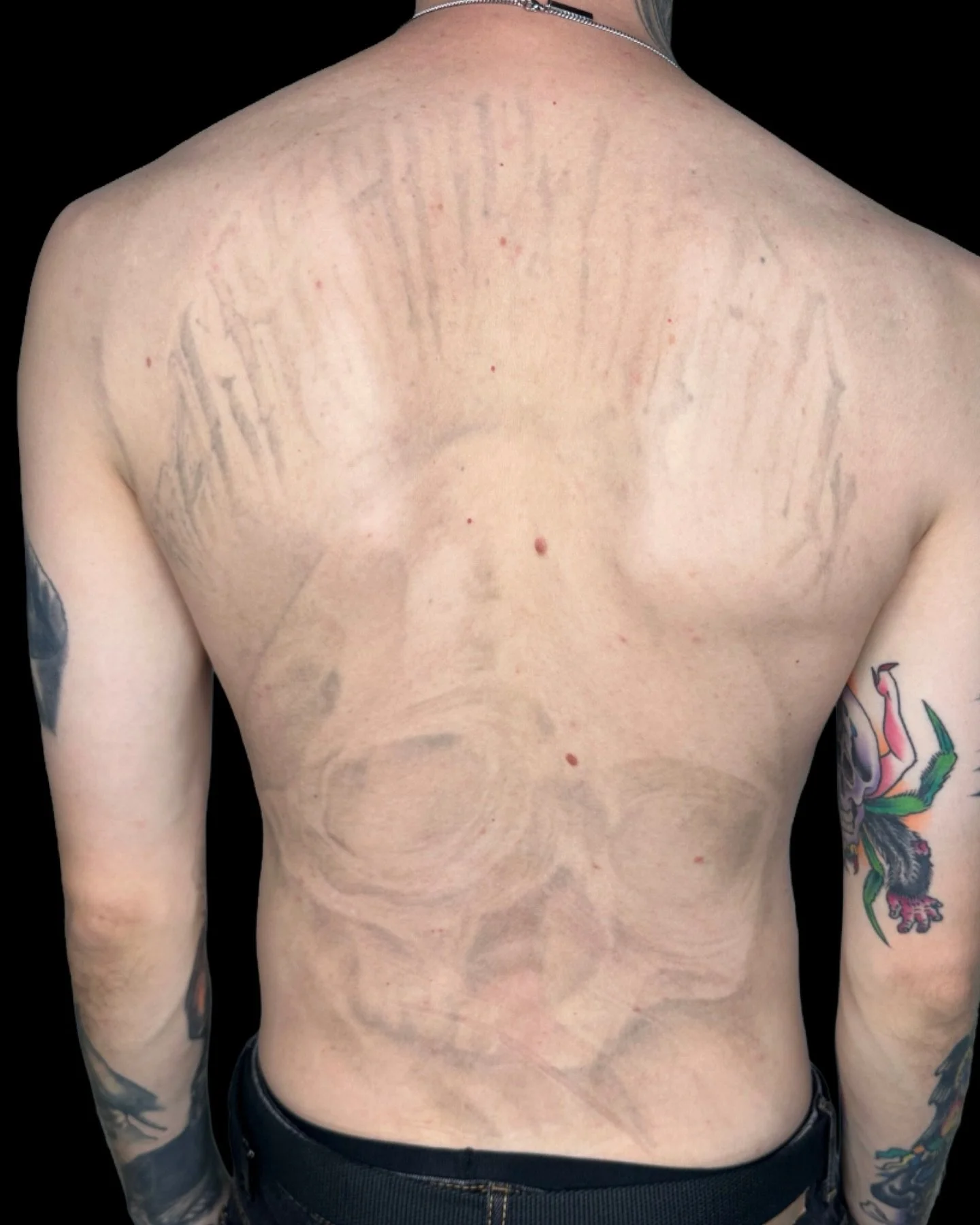 ⚡️ 4 SESSIONS ⚡️ 

Who said getting a blast over was your only option? We got you covered for your cover up dream tattoo!