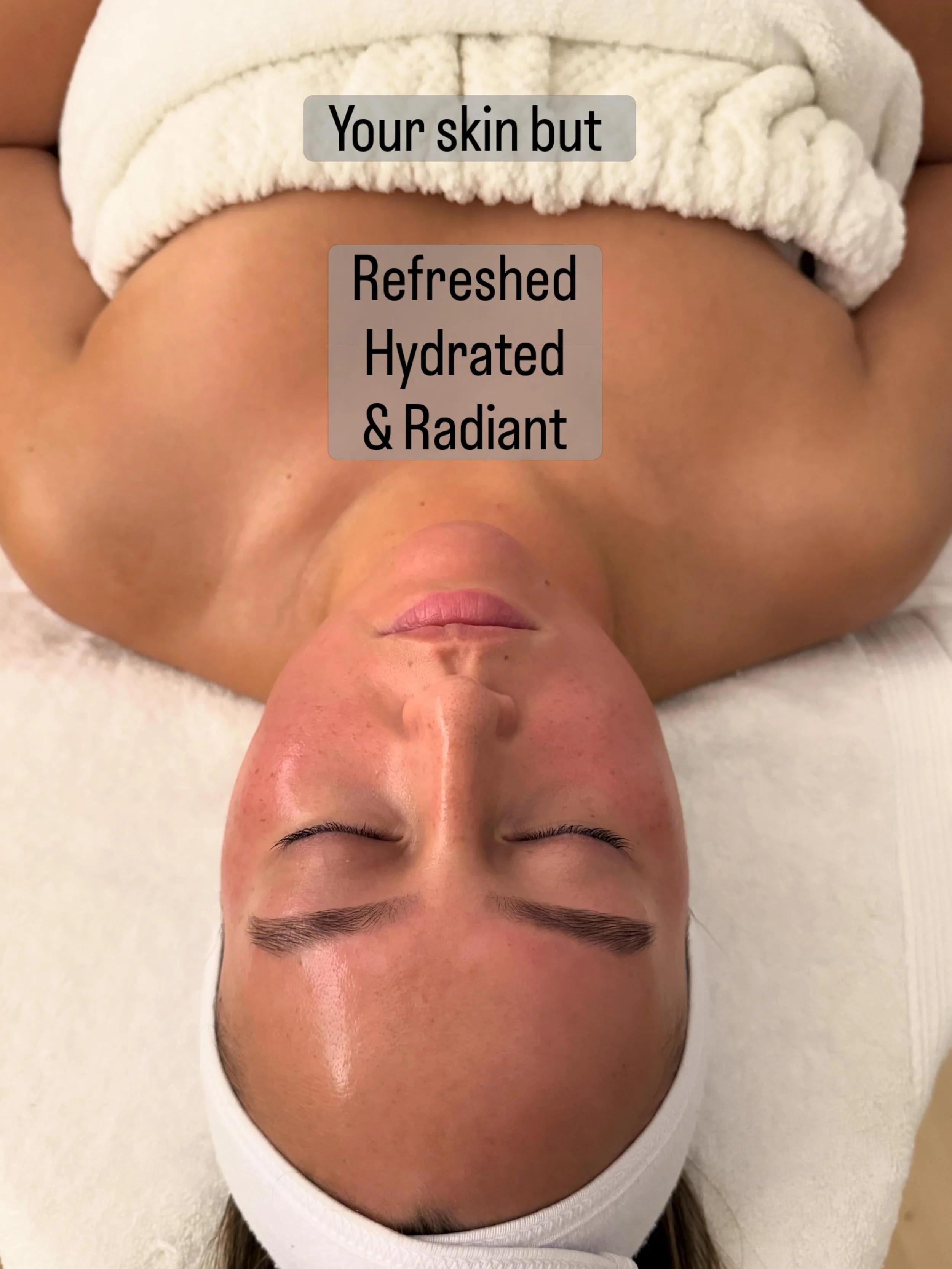 Your skin, but hydrated, smooth and congestion-free. ✨

Healthy skin doesn&rsquo;t happen overnight; it comes from consistency, the right treatments, and a personalised approach.

Whether your goal is improving hydration, refining texture, reducing c