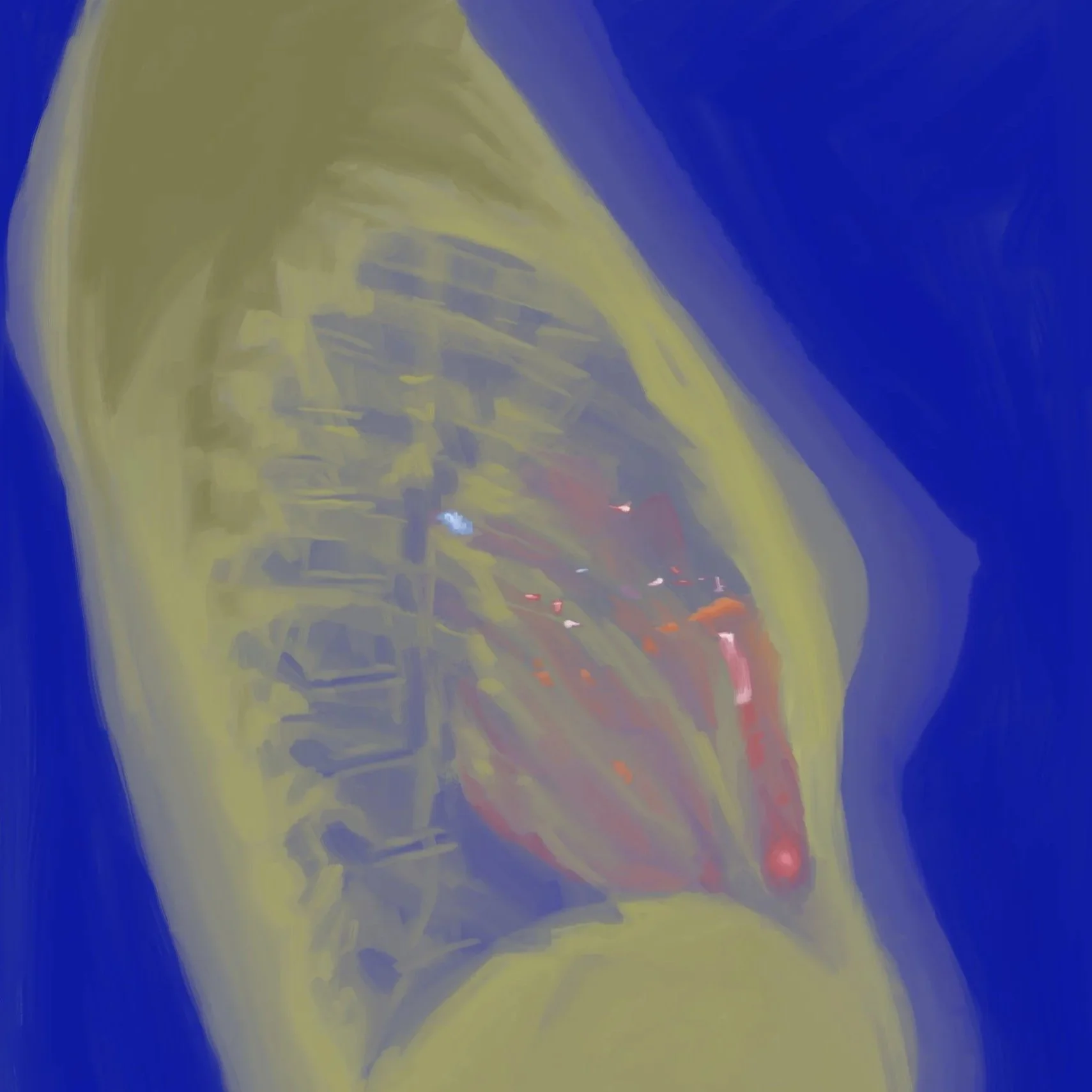 Xray I