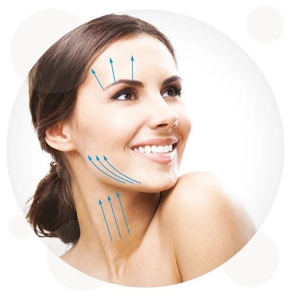 Woman smiling with blue directional lines on face, indicating cosmetic procedure areas.