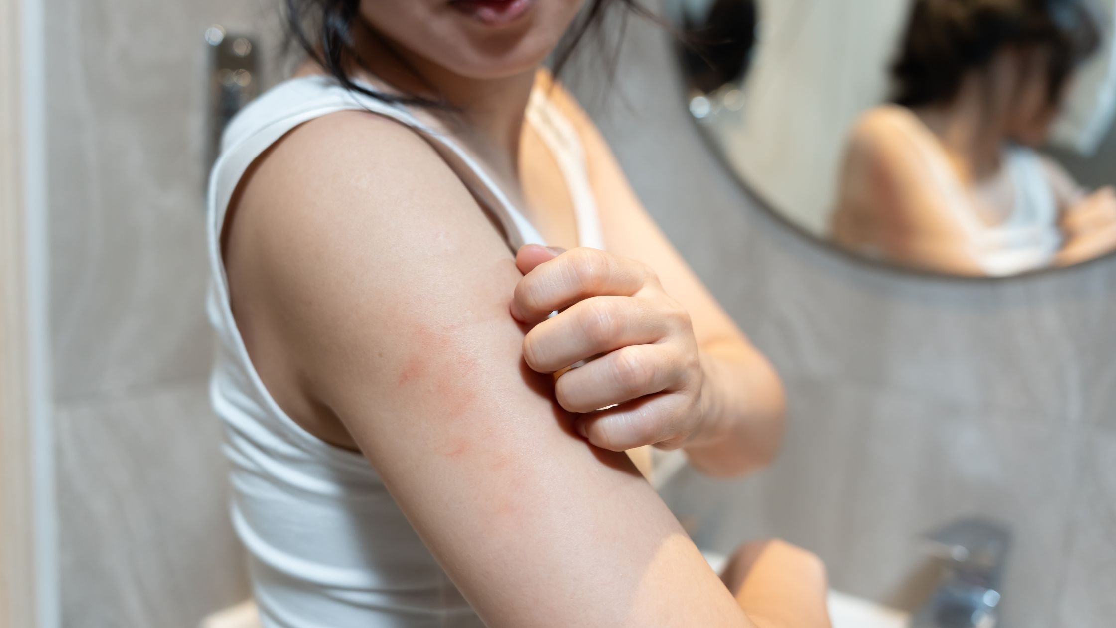 Person scratching a red irritated area on their upper arm