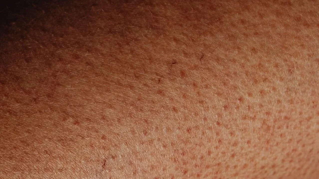 Close-up of sensitive skin with visible bumps and hair follicles