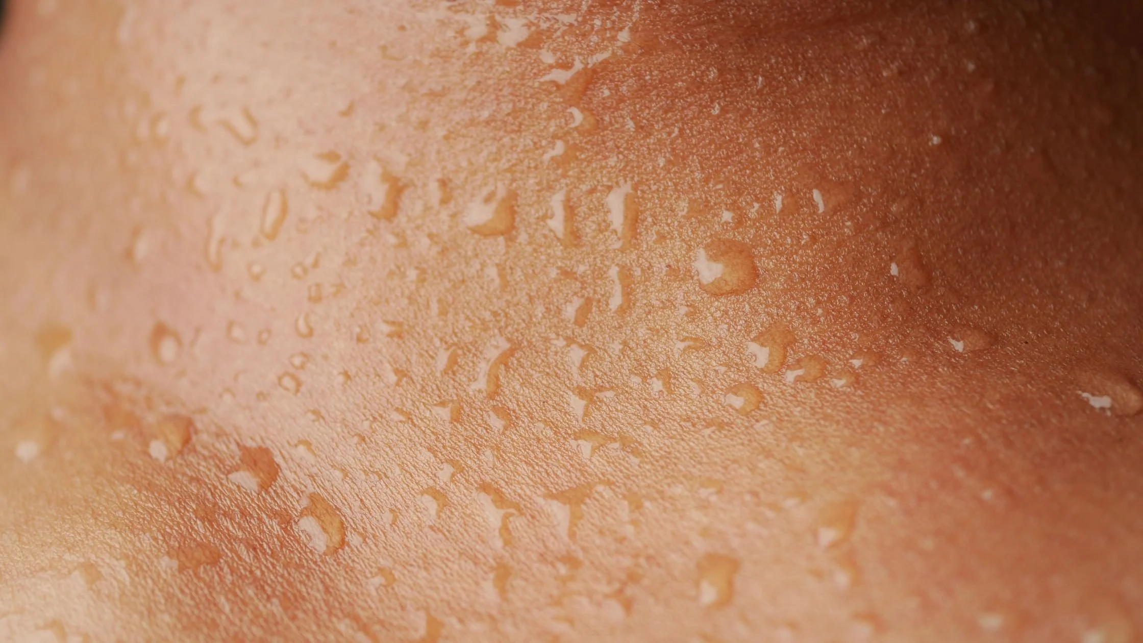 Close-up of skin with droplets of sweat